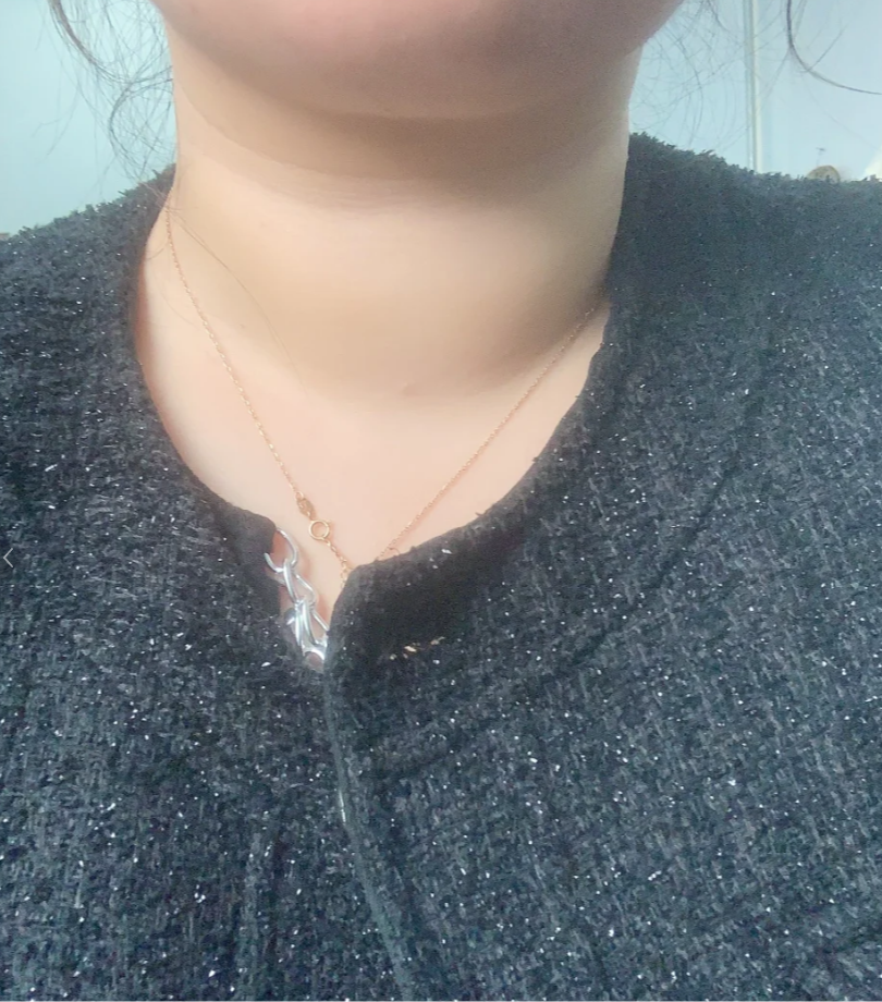 为什么脖子又粗又短?