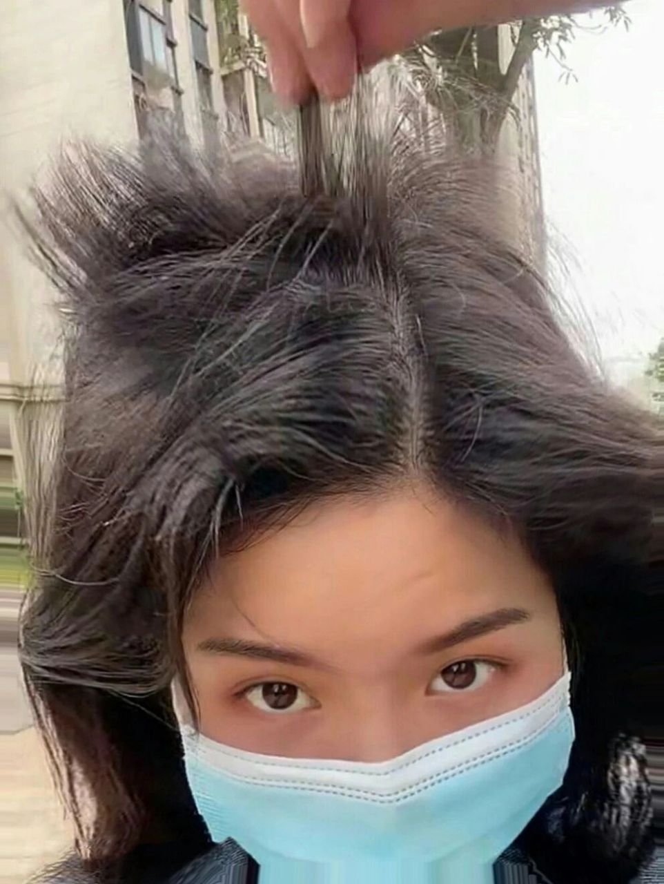 生发液用多了,头顶炸毛好丑呜呜呜 98很早之前我就有掉发的情况