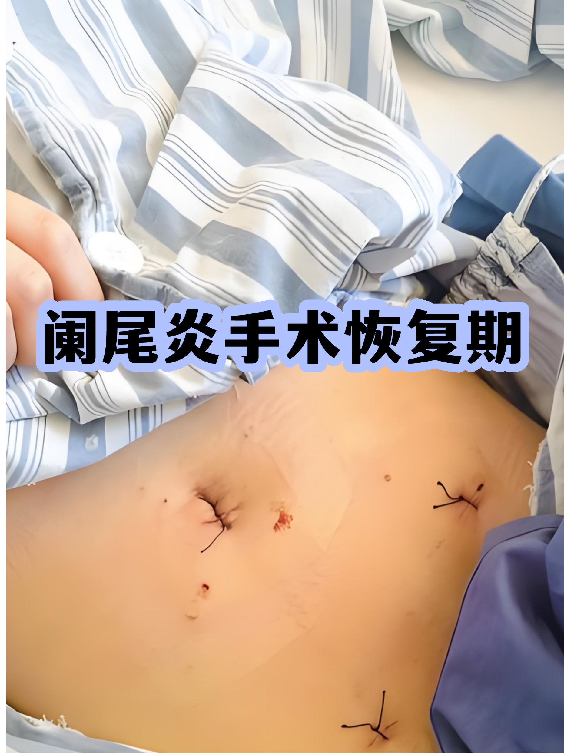 关于301医院代诊挂号服务出院居家护理提醒，科学恢复身体的信息