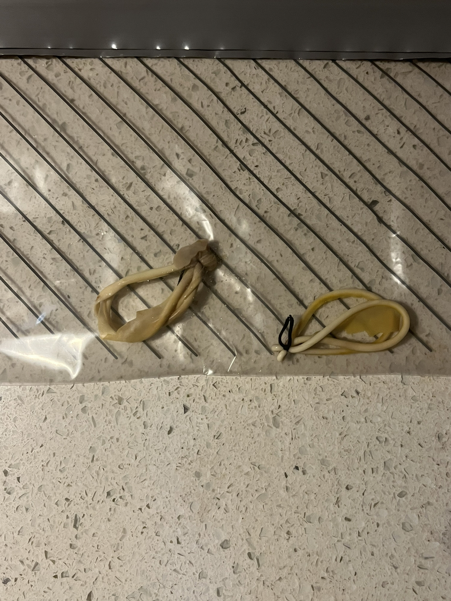 肛瘘手术第八天 昨天掉线后的剧痛原因找到了,合着是挂了两根线.