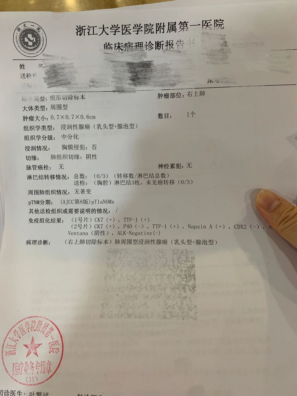 肺结节手术病例报告犹如晴天霹雳 今天去医院处理了一下手术伤口 顺便