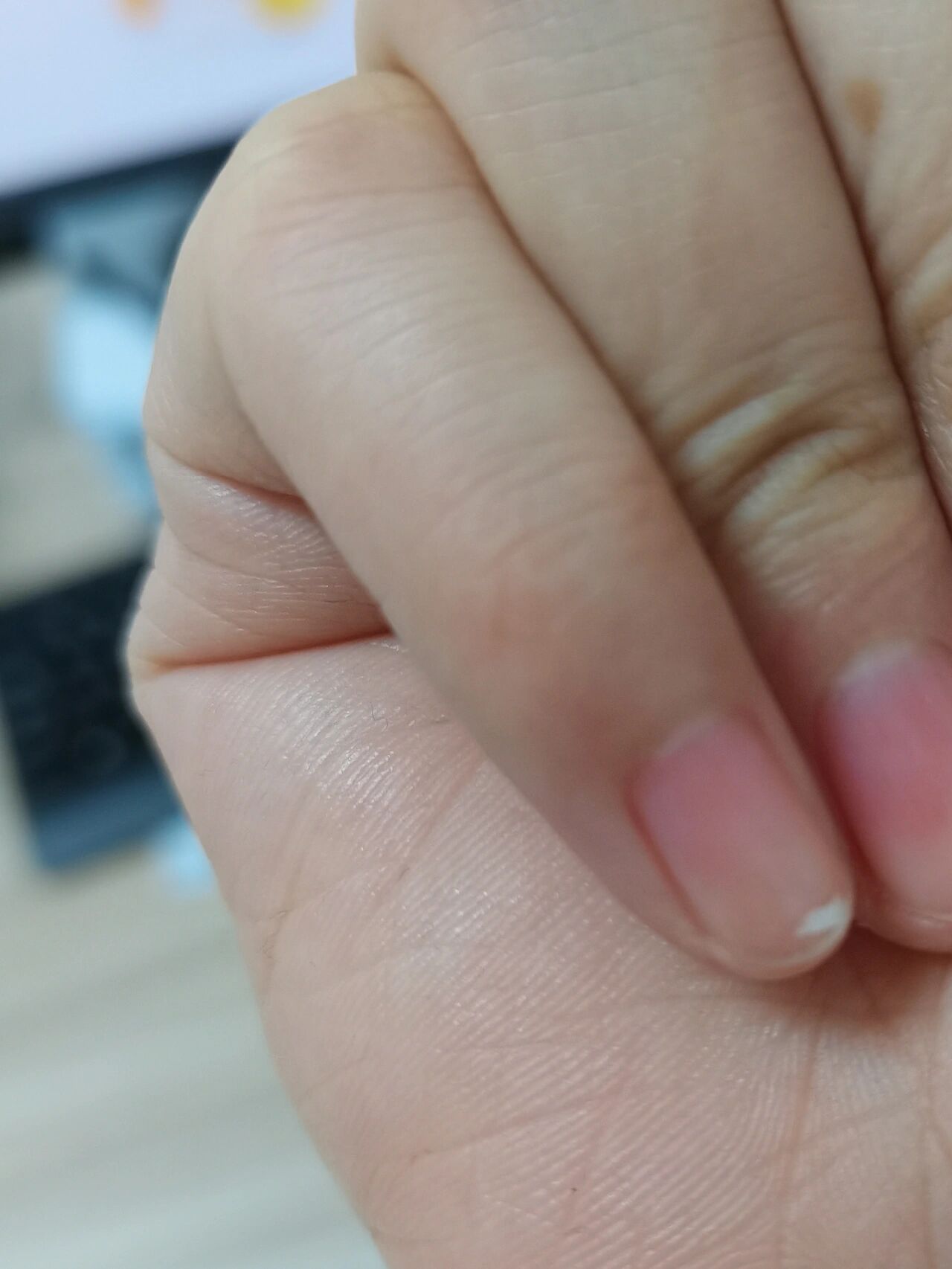 小拇指甲有白色  小拇指甲有白色的点,原来在指甲根部,指甲长长了