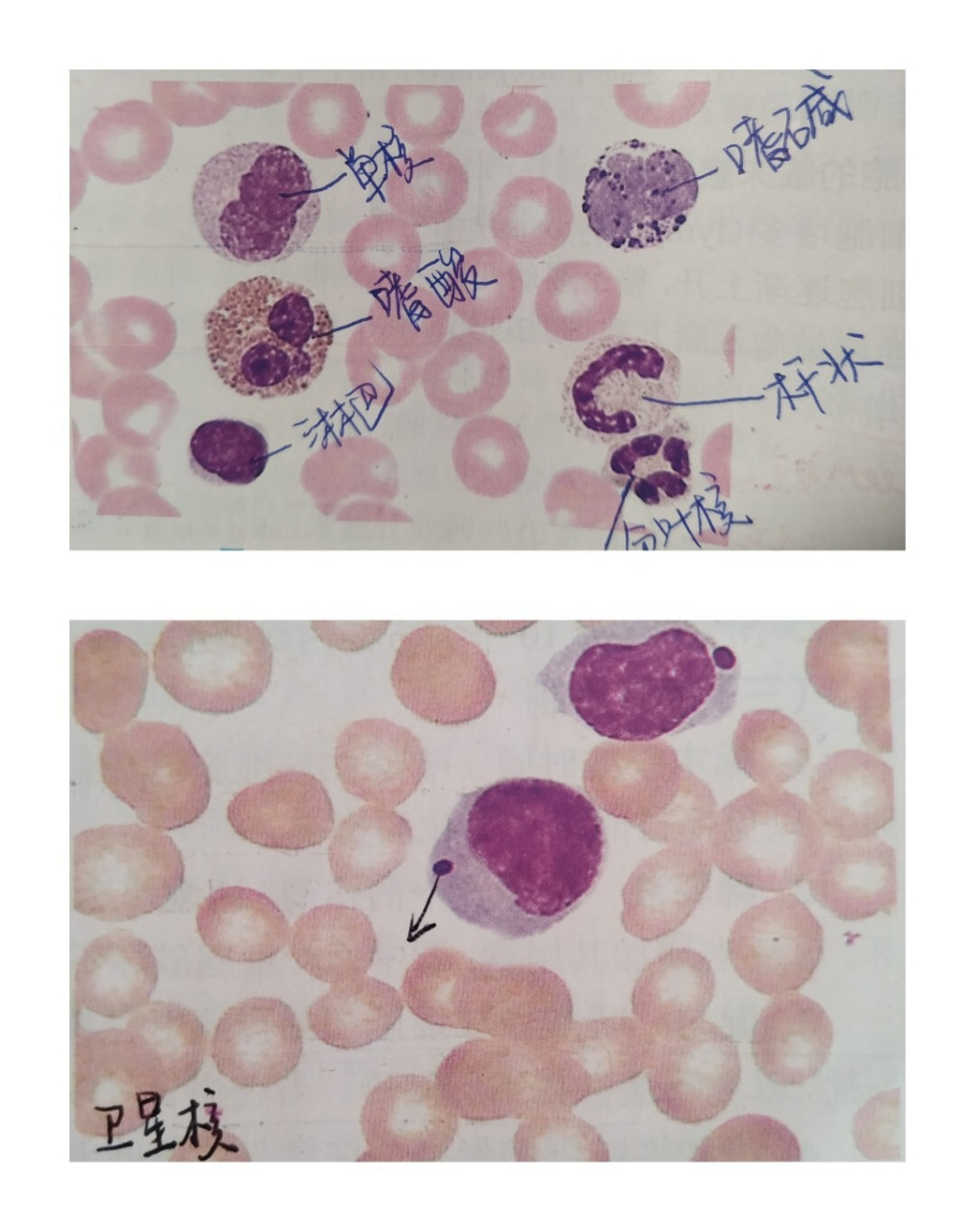 【检验】形态学图谱②Ⅱ白细胞形态学图谱