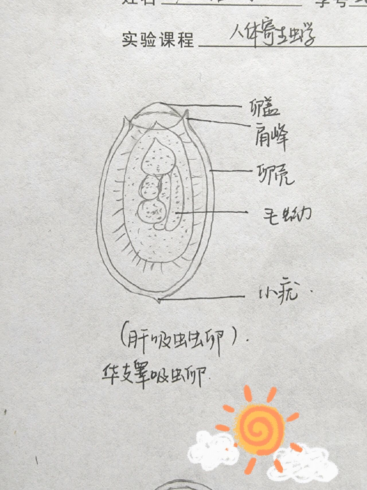 彩蚴吸虫 解剖图片