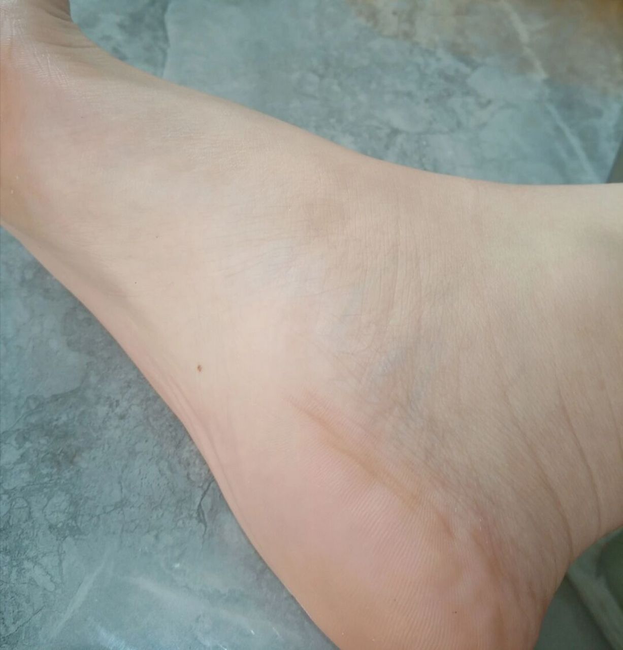 女,手心脚心都长了颗痣,不是天生的,就近两年长出来的(都是右边)