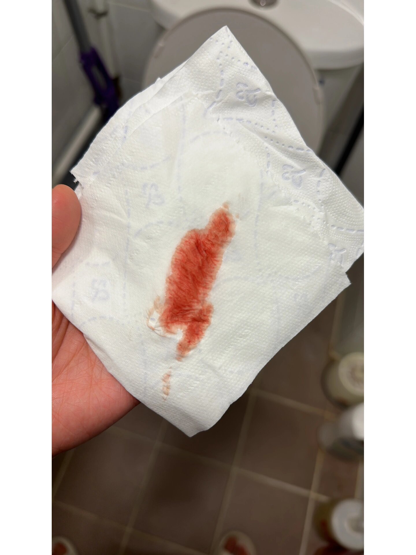 孕初期出血 能保住嗎?