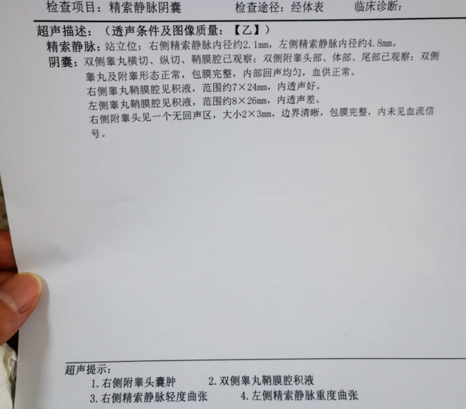 右下腹和睾丸隐隐作痛最常见的原因是精索静脉曲张,但也可能是输尿