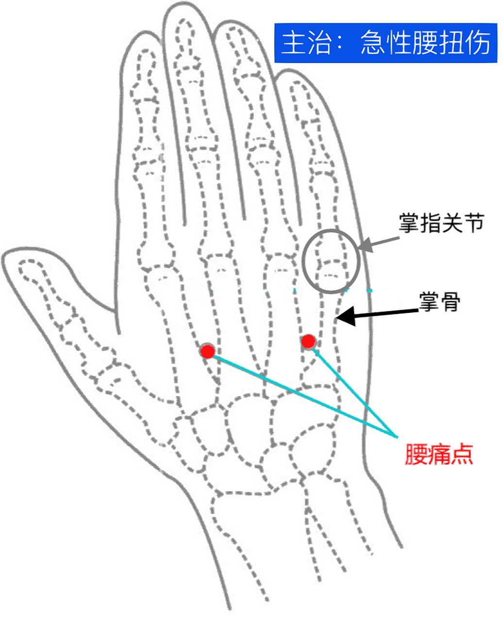 一天记一个穴位—腰痛点 腰痛点,经外奇穴. 主治:急性腰扭伤.