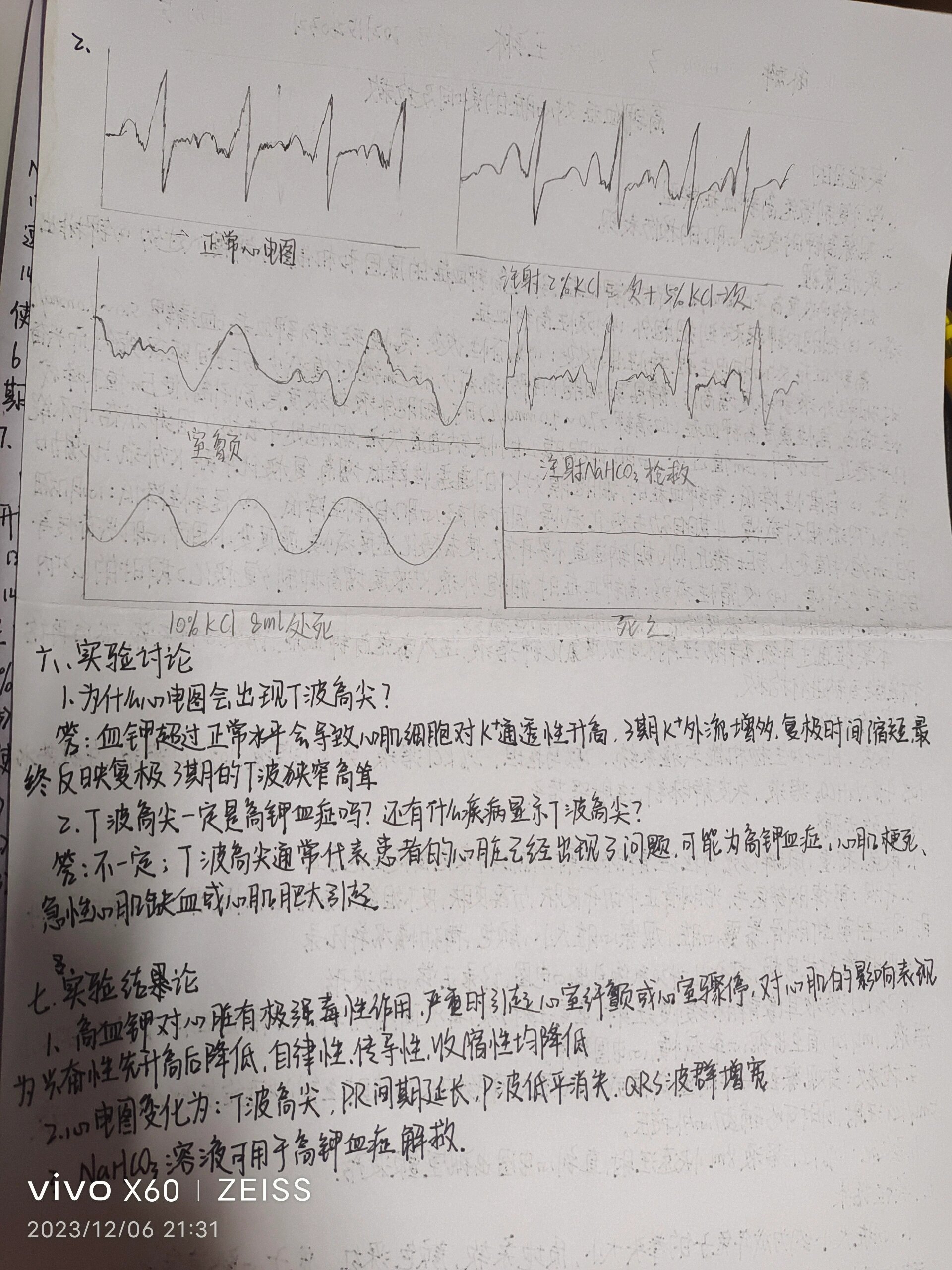 心电图实验报告图片