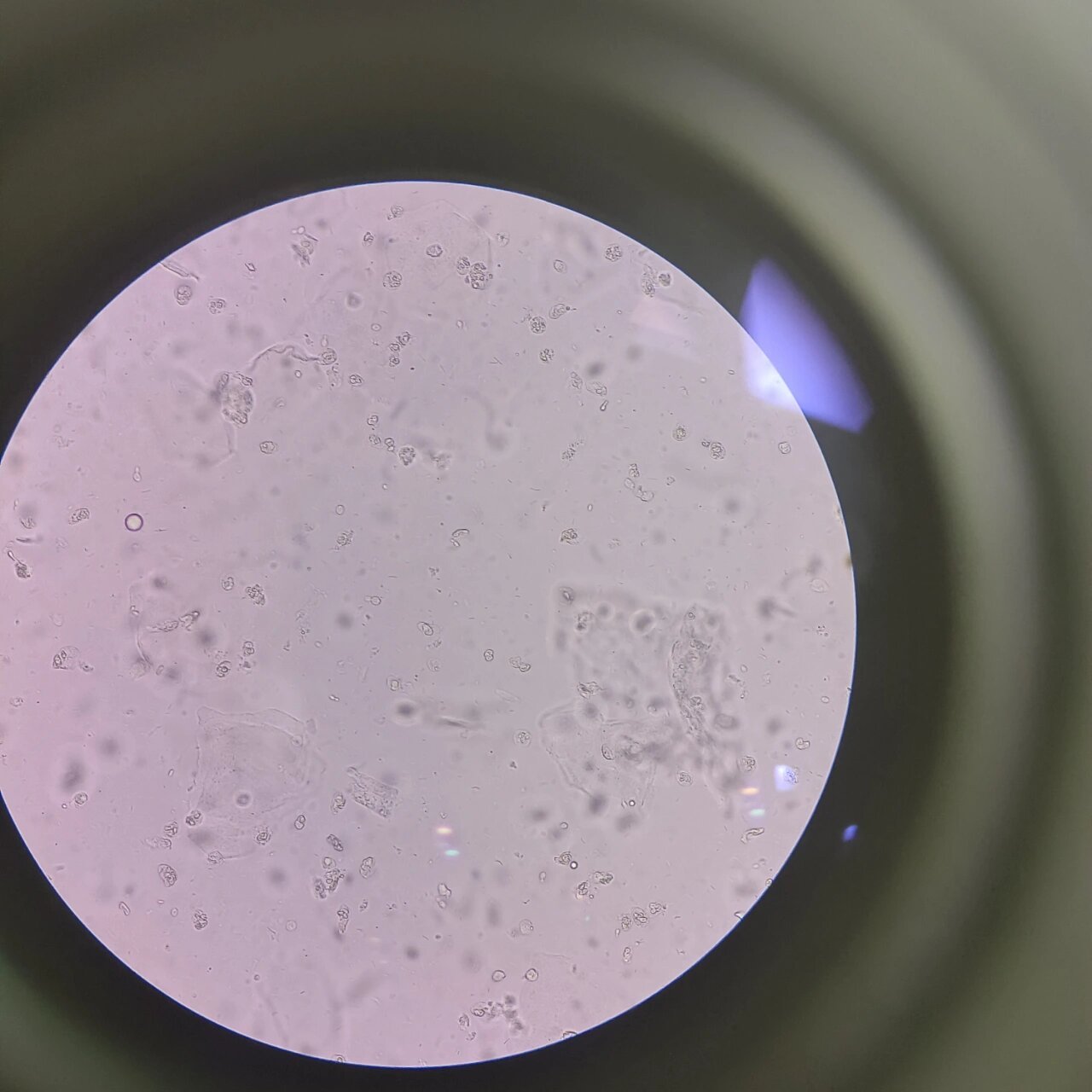 白带镜检~真菌孢子