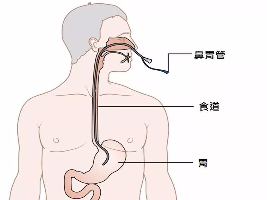 胃管在鼻腔的解剖图图片