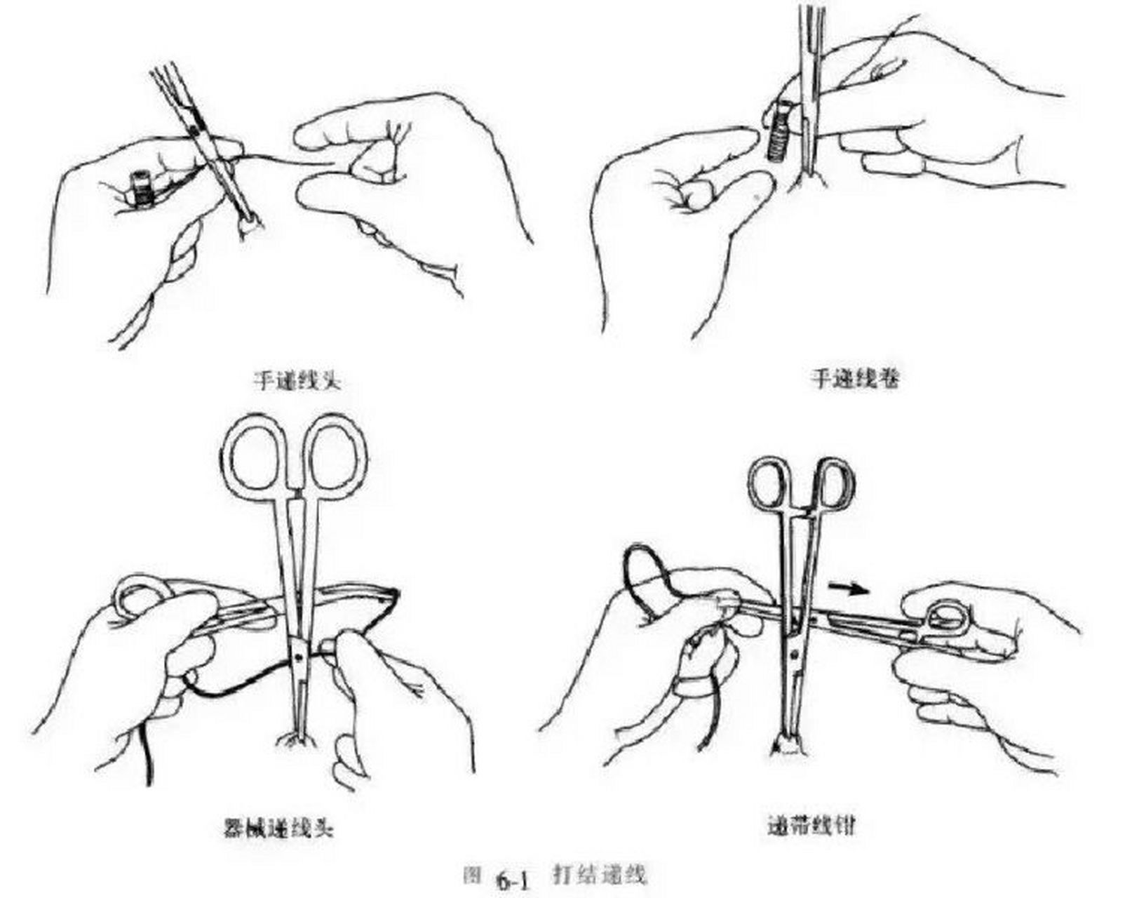 外科单手打结步骤图解图片