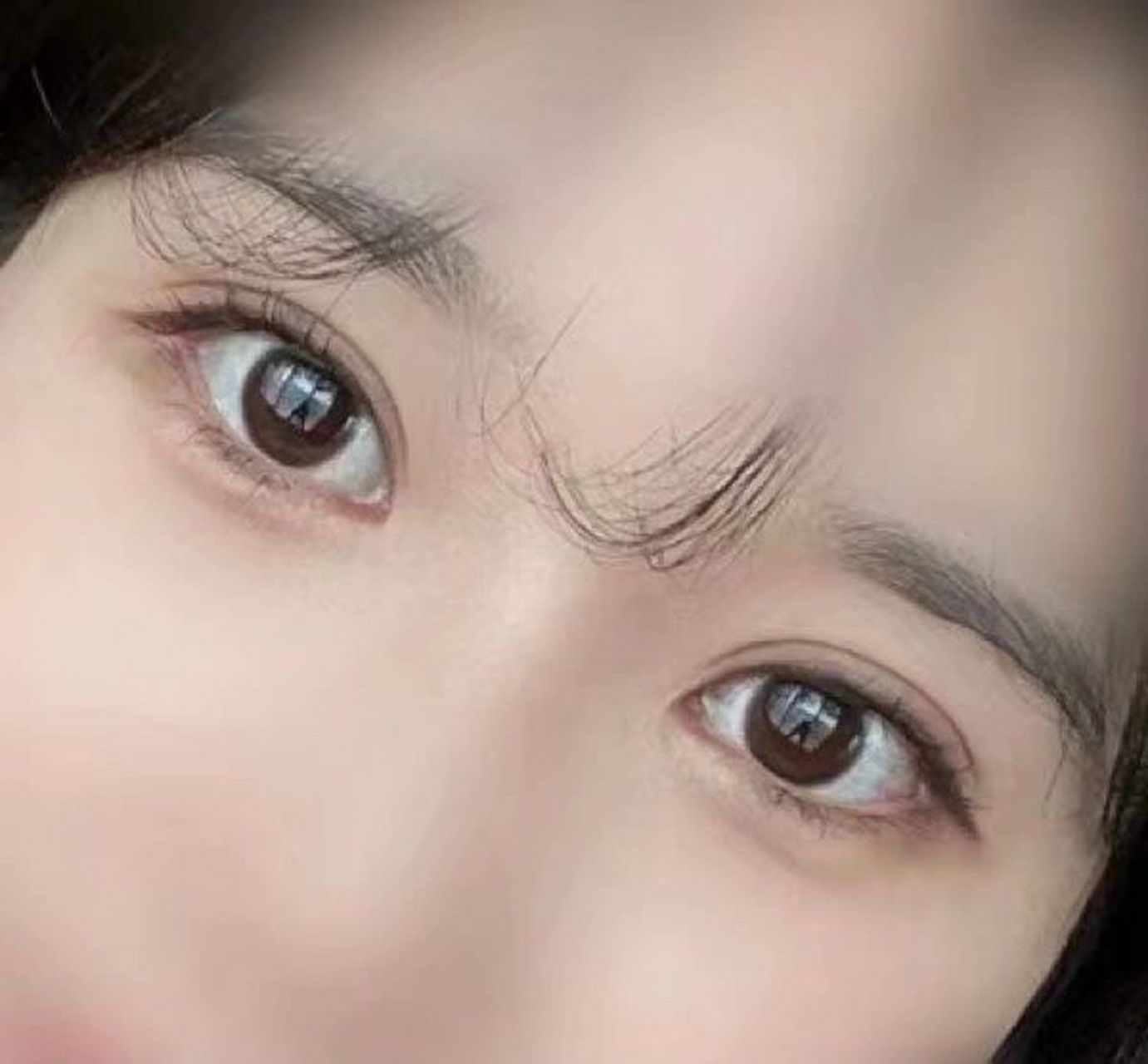 南京双眼皮 果然平扇没有选错 我本来喜欢开扇,但医生建议我试试平扇