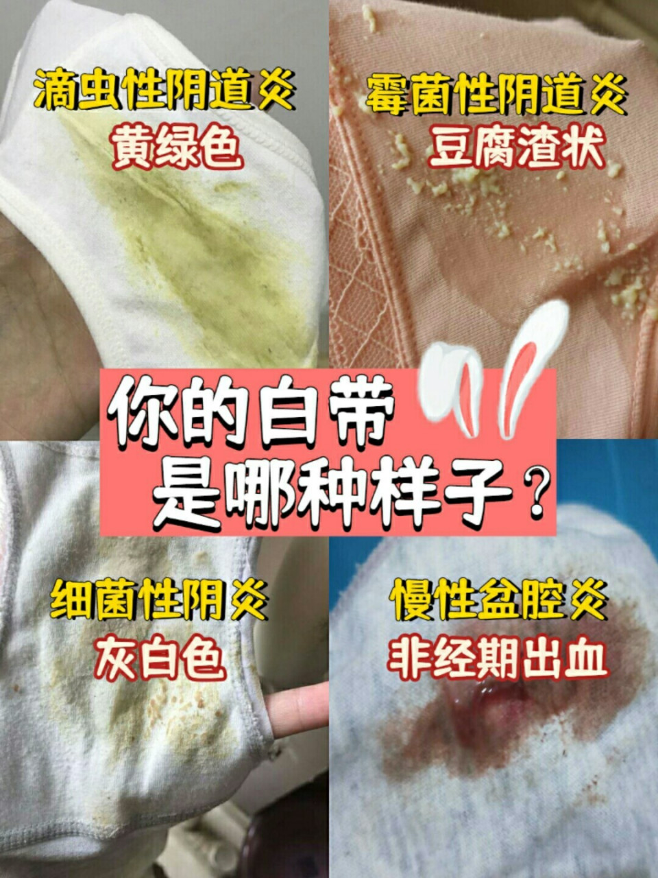 妇科炎症的种类很多,73女孩纸们应该多学会一些妇