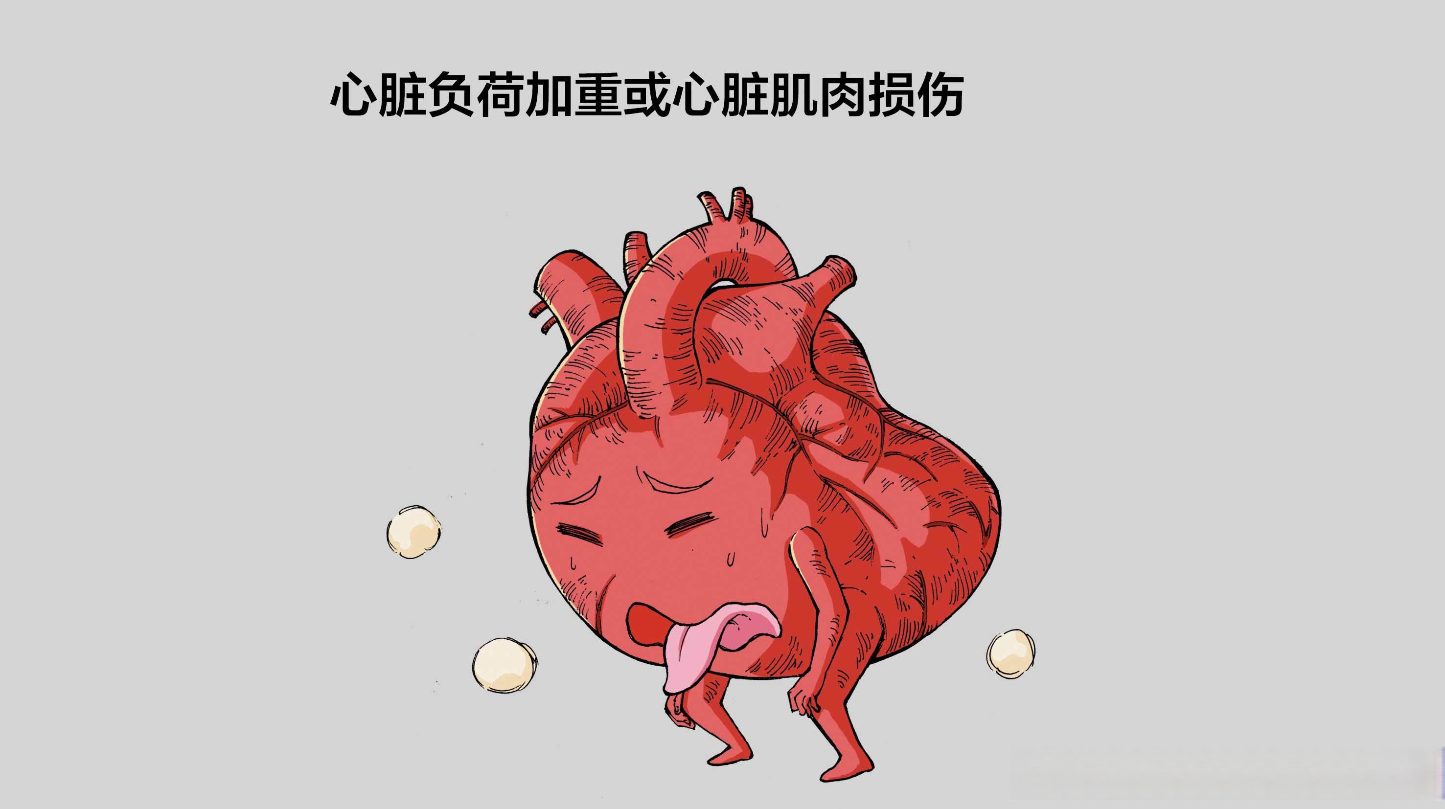 的图片大全心力衰竭 气喘心脏输出下降心机毒素动画图片心脏 衰老卡通
