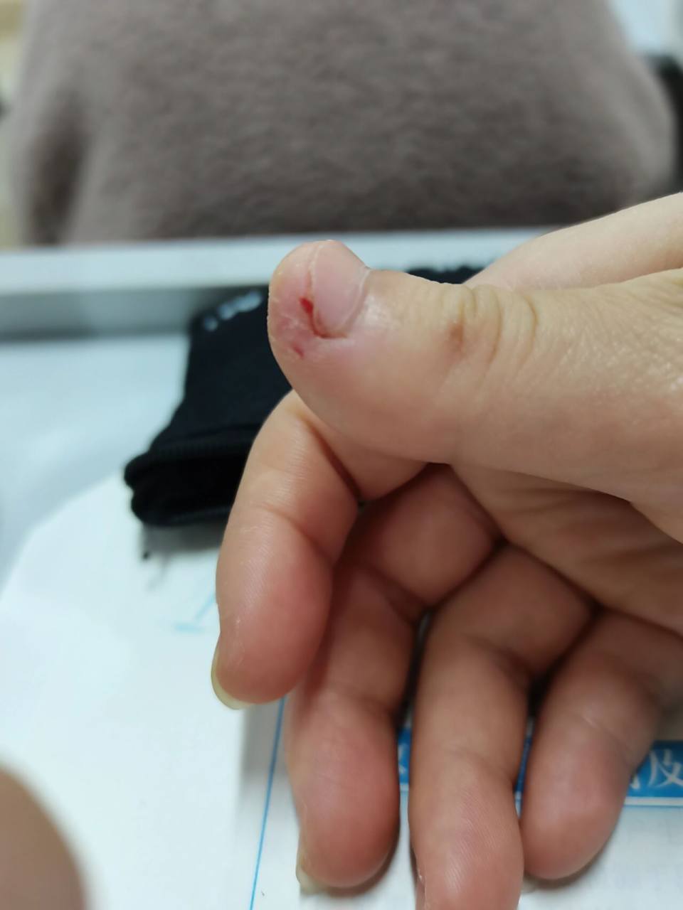 指甲旁边的肉裂开 指甲的同一个位置总是会裂开,就这里一个地方,痛的