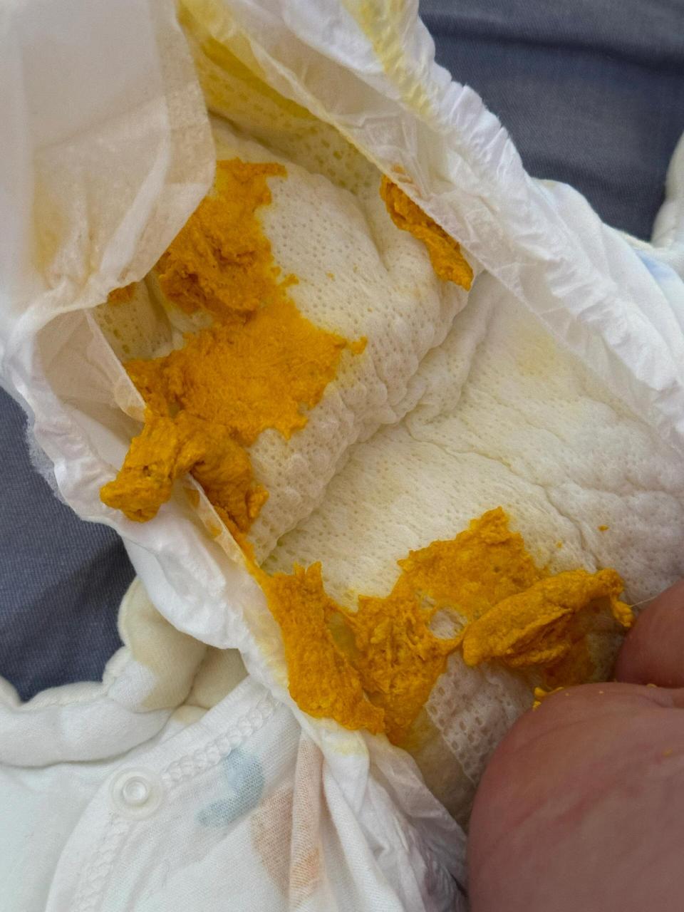 纯母乳喂养 月子里的宝宝拉奶瓣 放屁崩屎 图一图二是没喝益生菌拉的