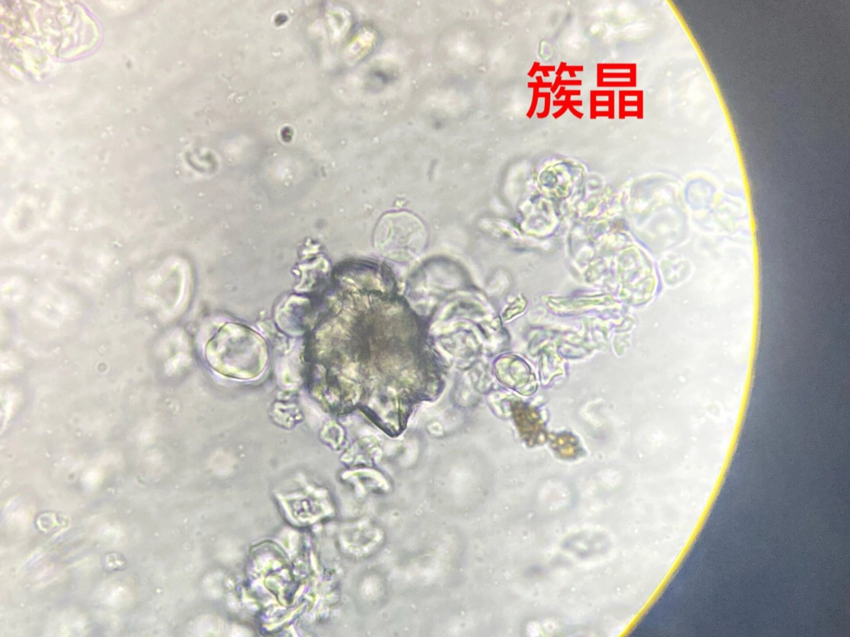 人参粉末显微鉴定图 树脂道碎片:内含黄色块状分泌物.
