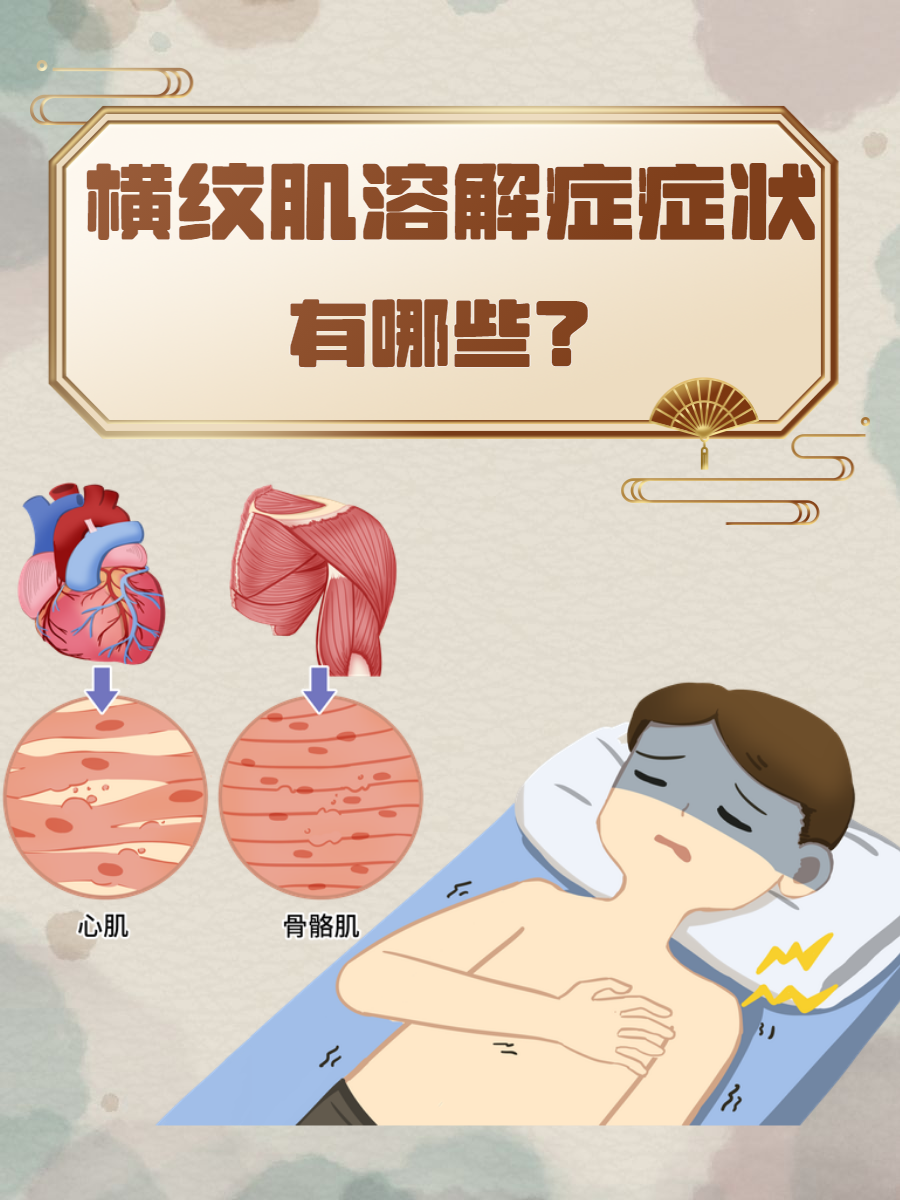 横纹肌溶解症症状有哪些?