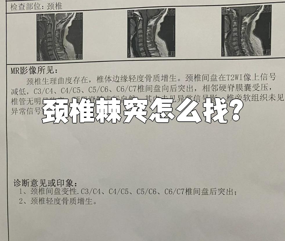 找颈椎棘突主要靠触摸,也可以结合观察和按压
