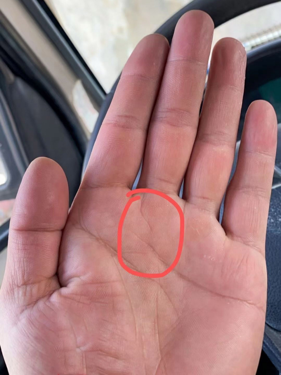 感情线尾端有分叉的男手,大部分是靠老婆来 感情线尾端有分叉的男手