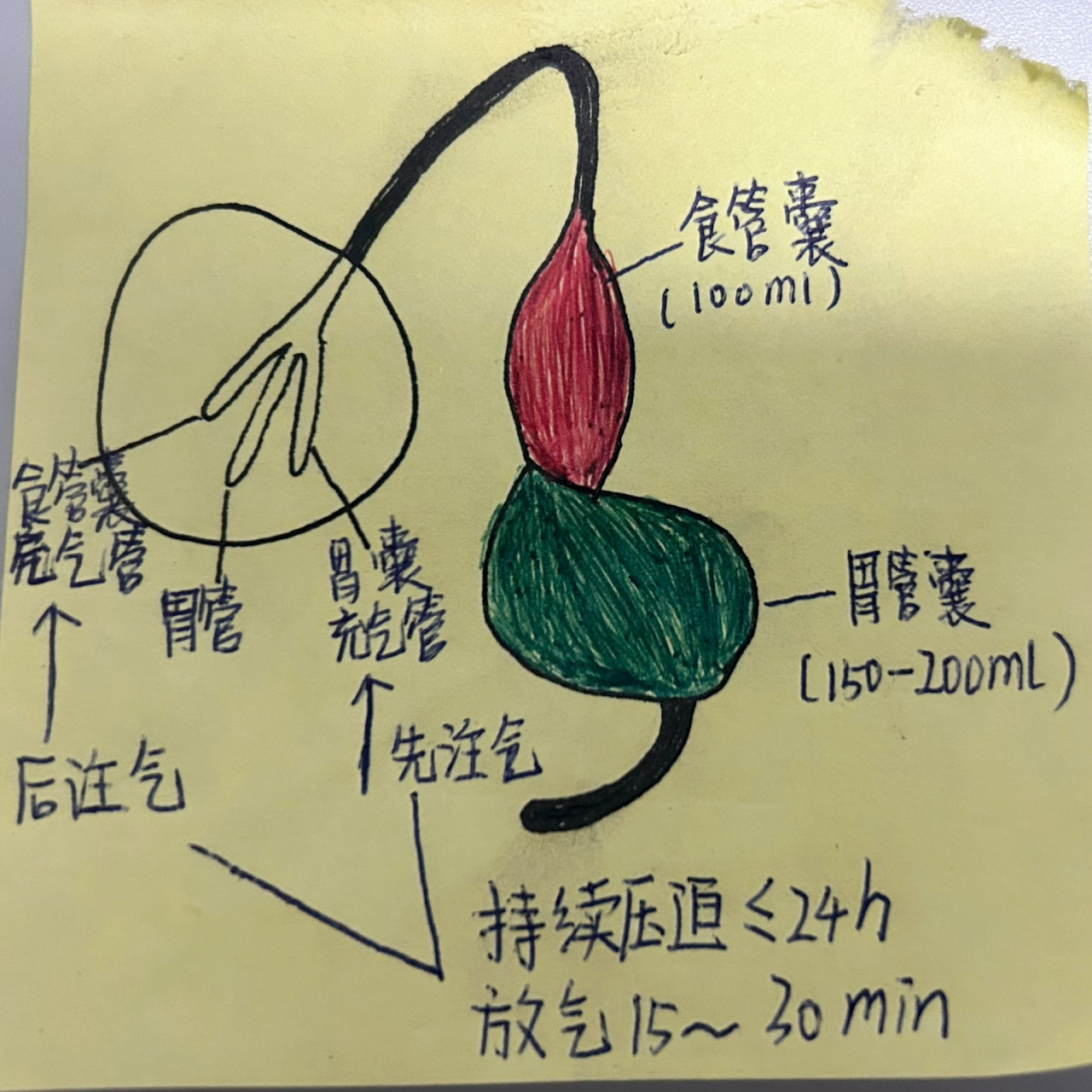 双腔气管导管图解图片