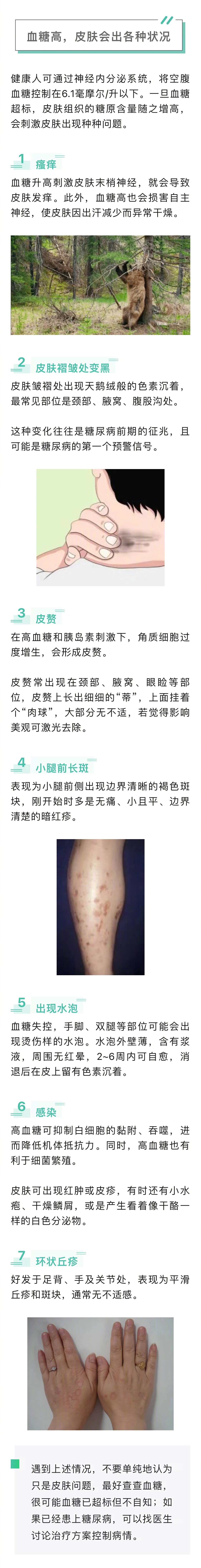 一旦血糖超标,皮肤组织的糖原含量随之增高,第一个信