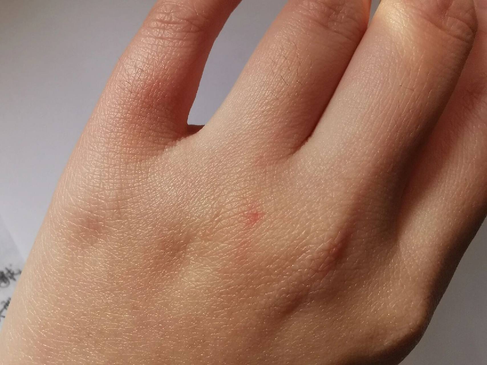 一个多月大的狗狗抓伤是不是要死了?