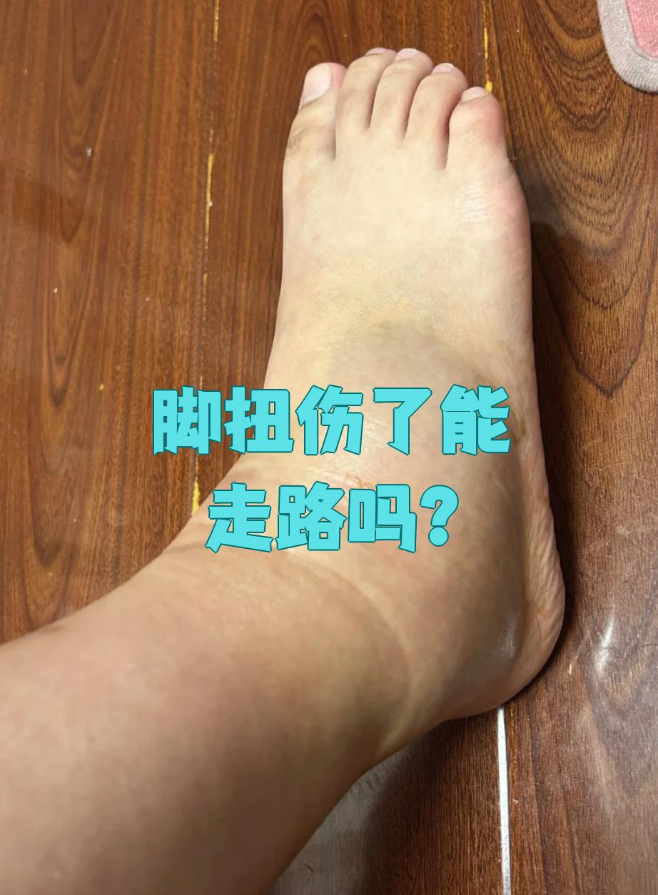 脚扭伤后能不能走路要看具体情况,但大多数时候不建议马上走路