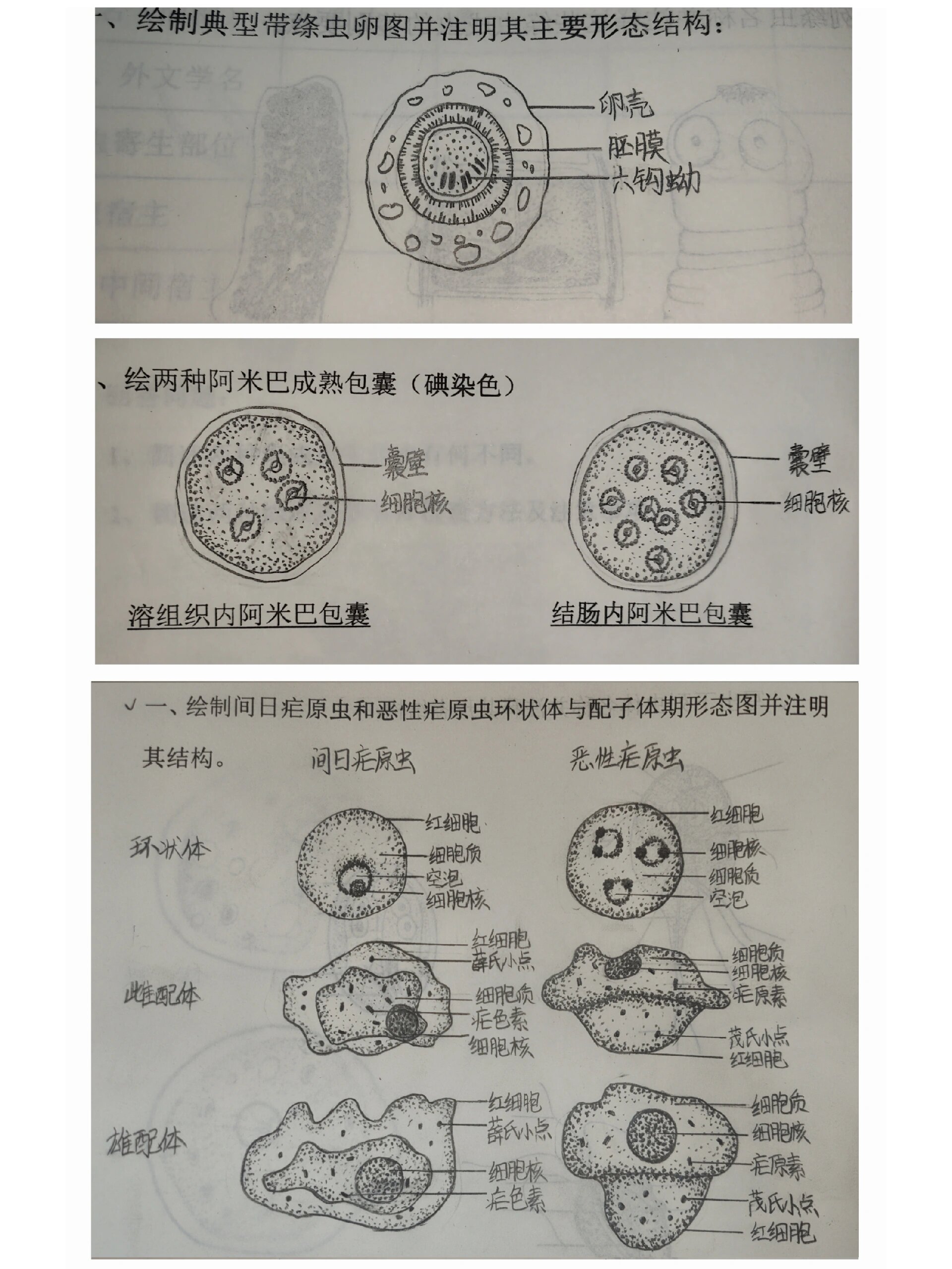 蛔虫卵结构图图片