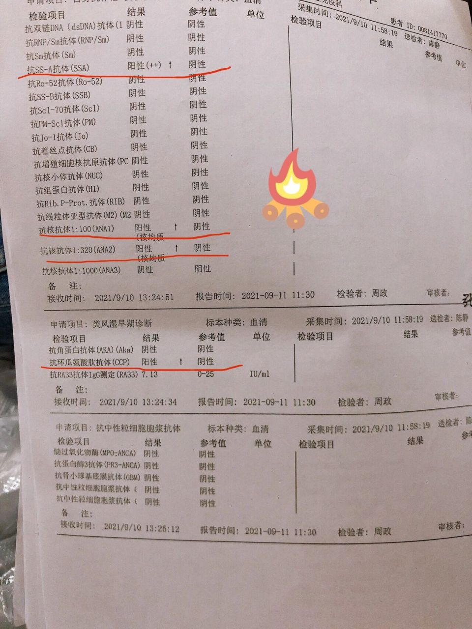 抗核抗体阳性说明什么 几项指标都呈阳性反应,已经确诊类风湿关节炎