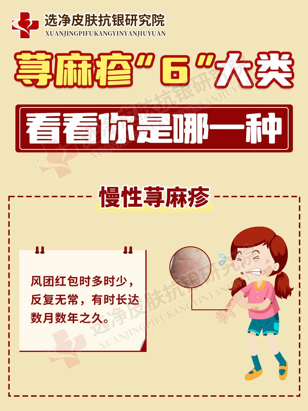 关于女性荨麻疹治疗方法的信息 关于女性荨麻疹治疗方法的信息（关于女性荨麻疹治疗方法的信息有哪些） 女性