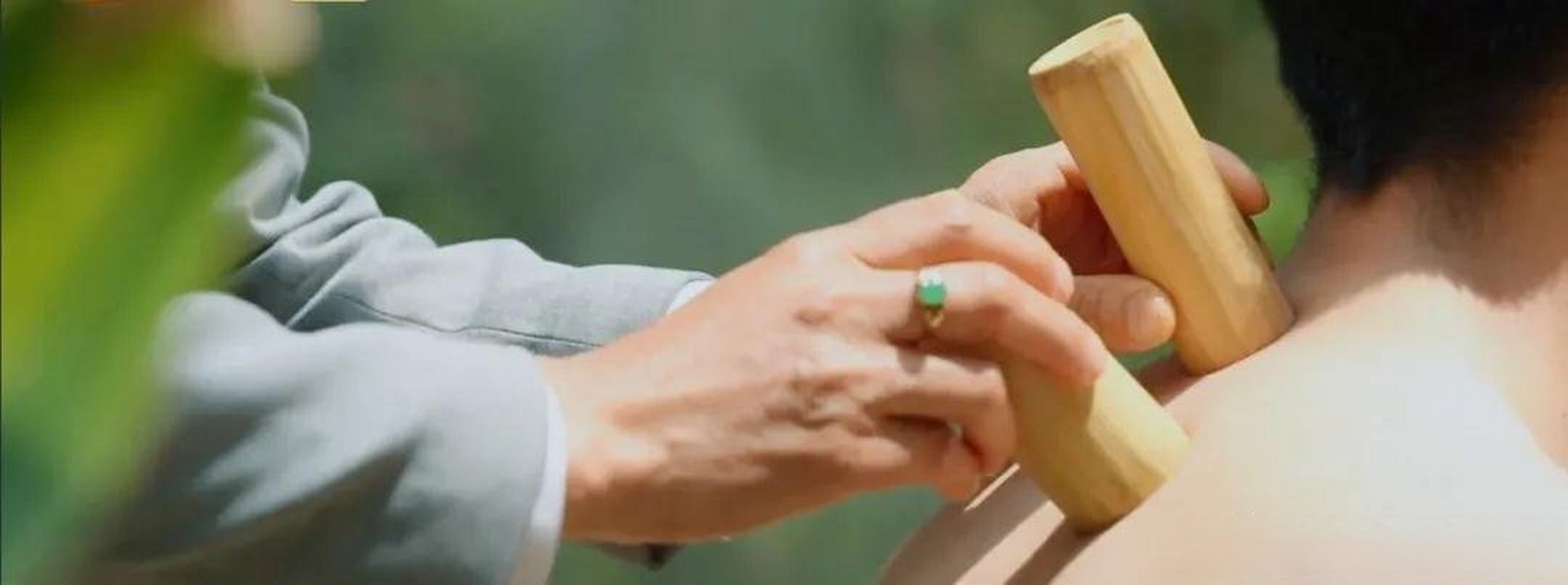 腾冲旅游# 蒸汽拔罐是热海一奇,也被叫做"拔水罐",这是热海对中医