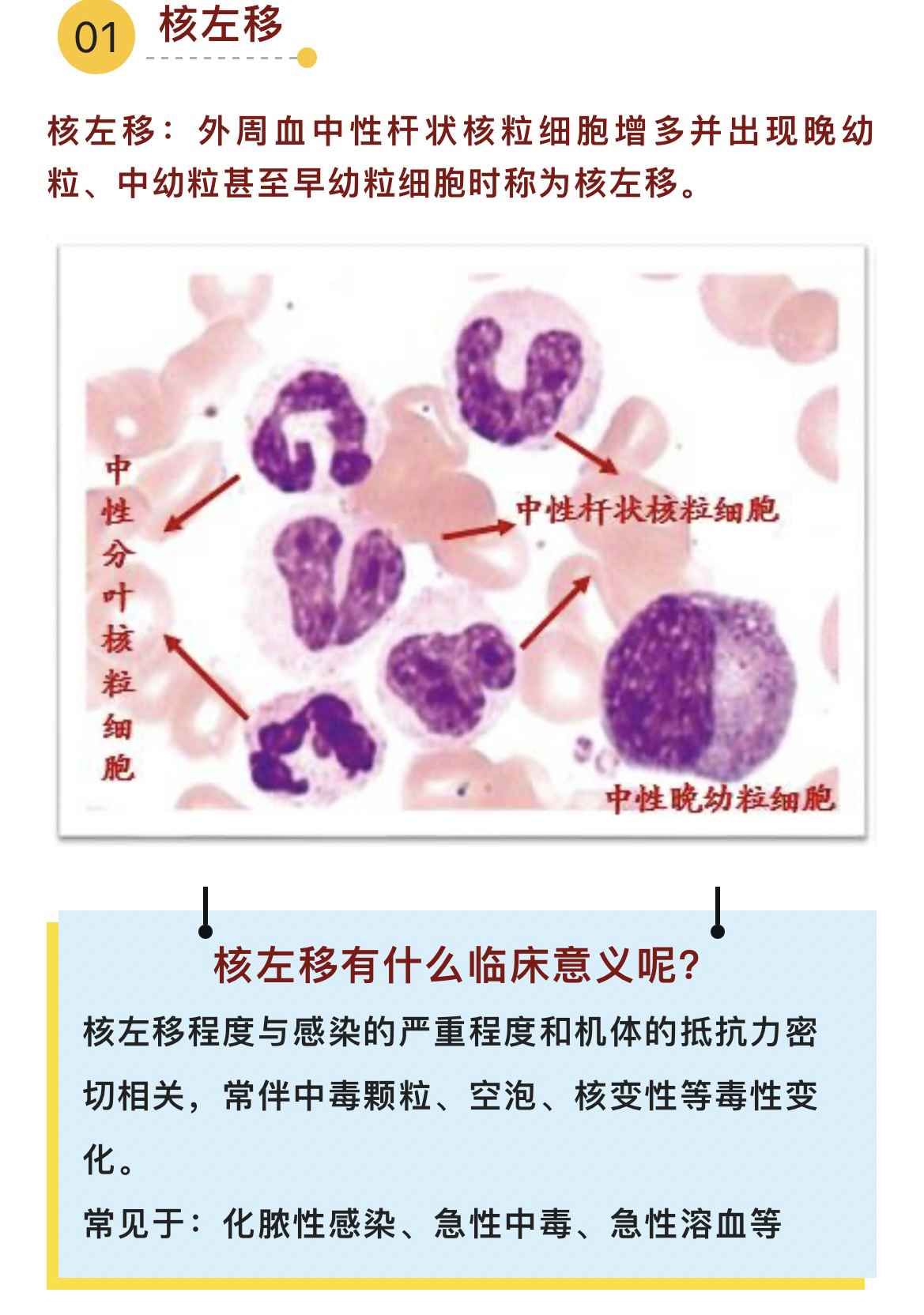 5种白细胞形态绘图图片