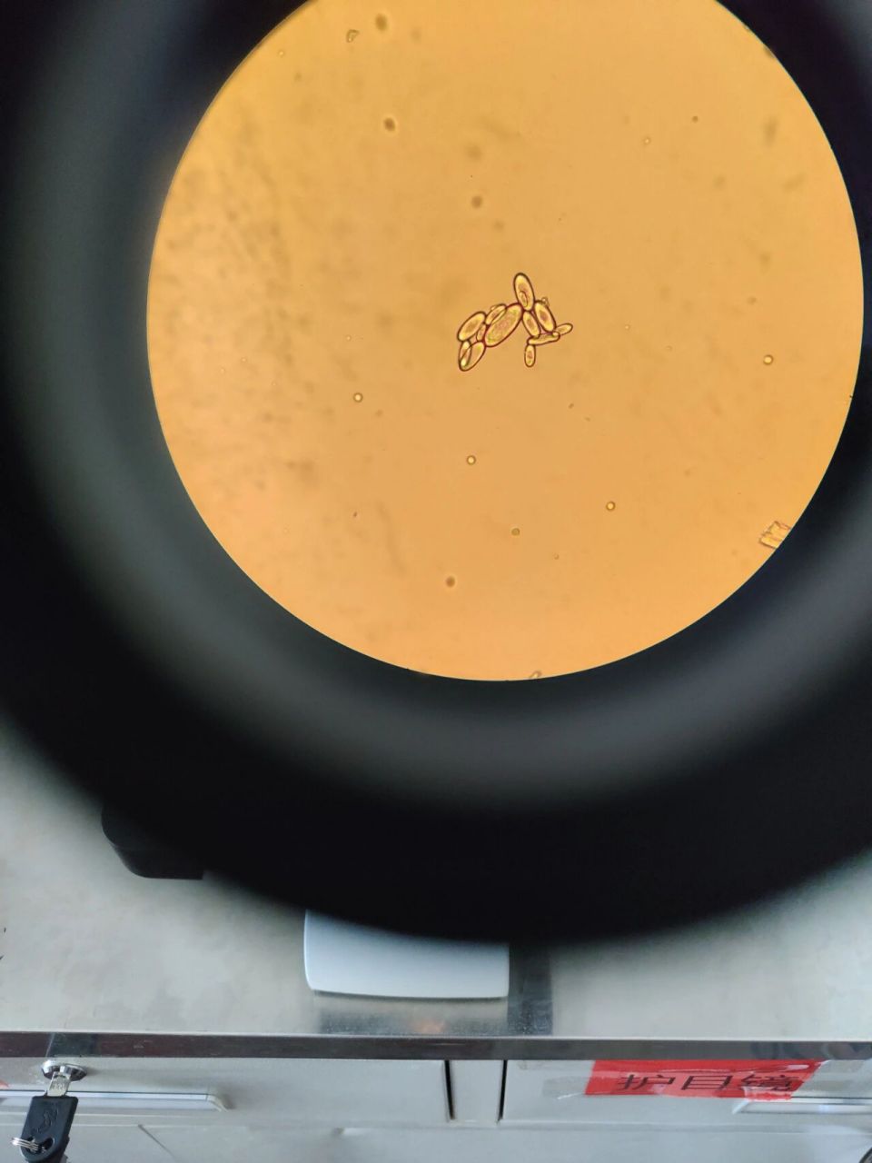 草酸钙簇晶显微图片图片