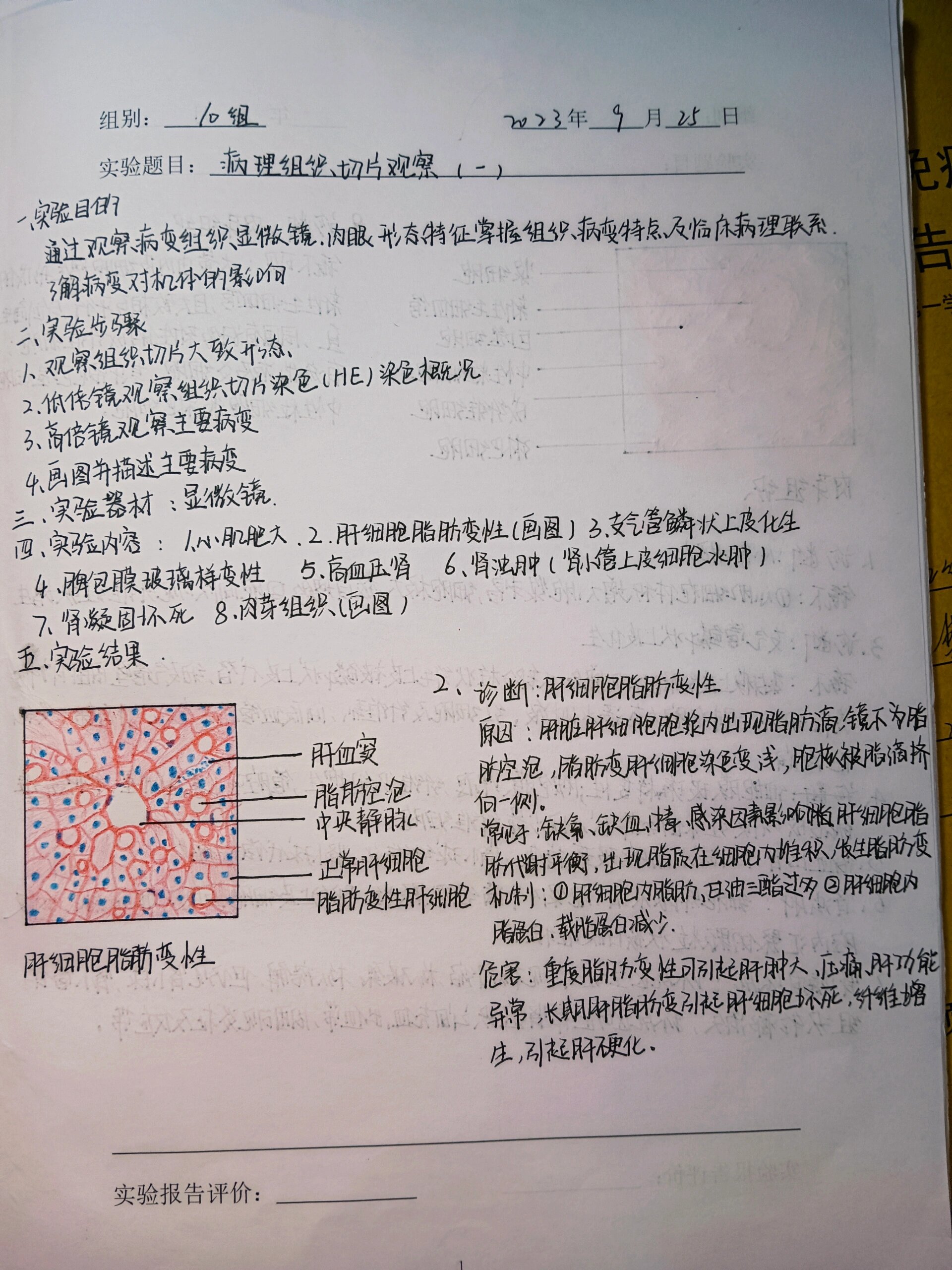 肉芽组织手绘图片