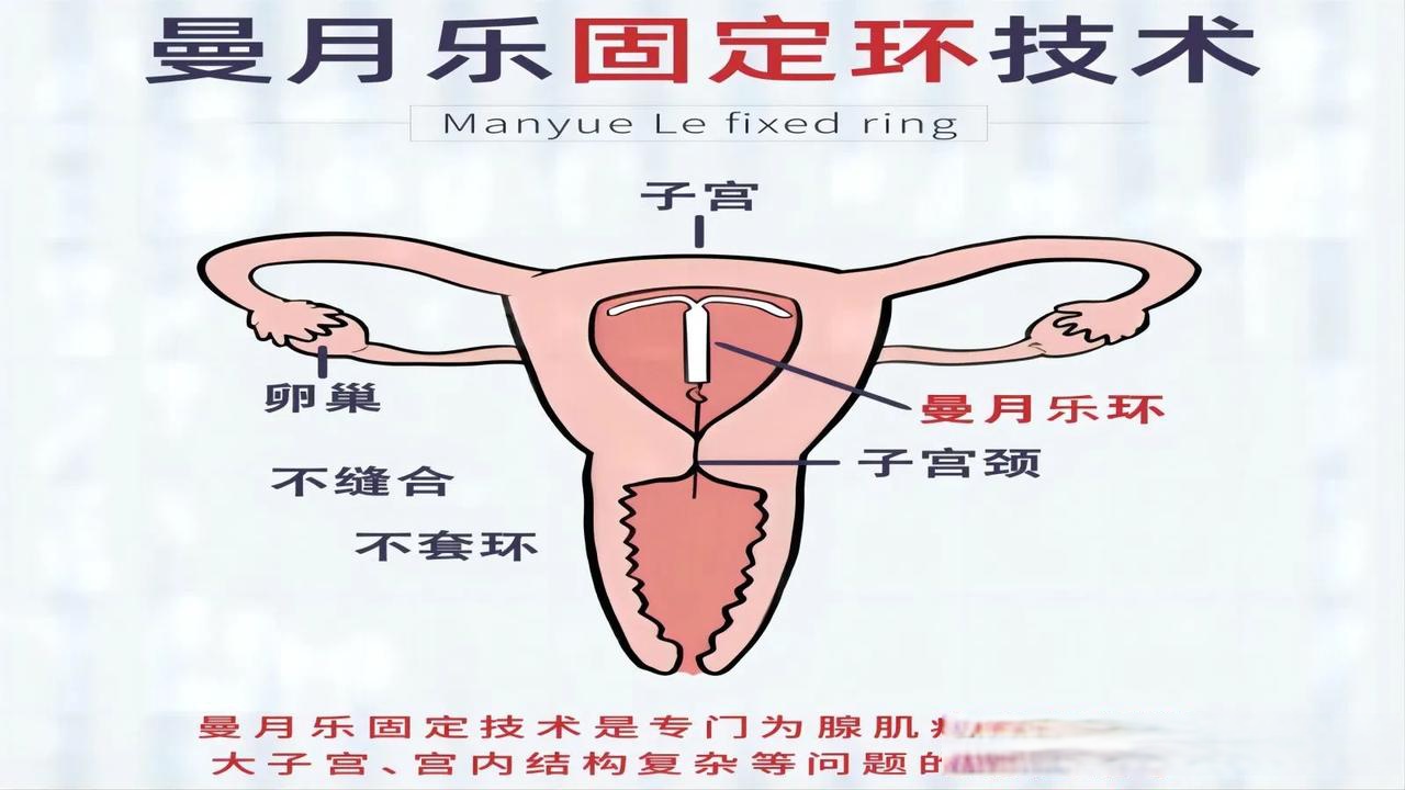 生理缩复环的位置图片图片