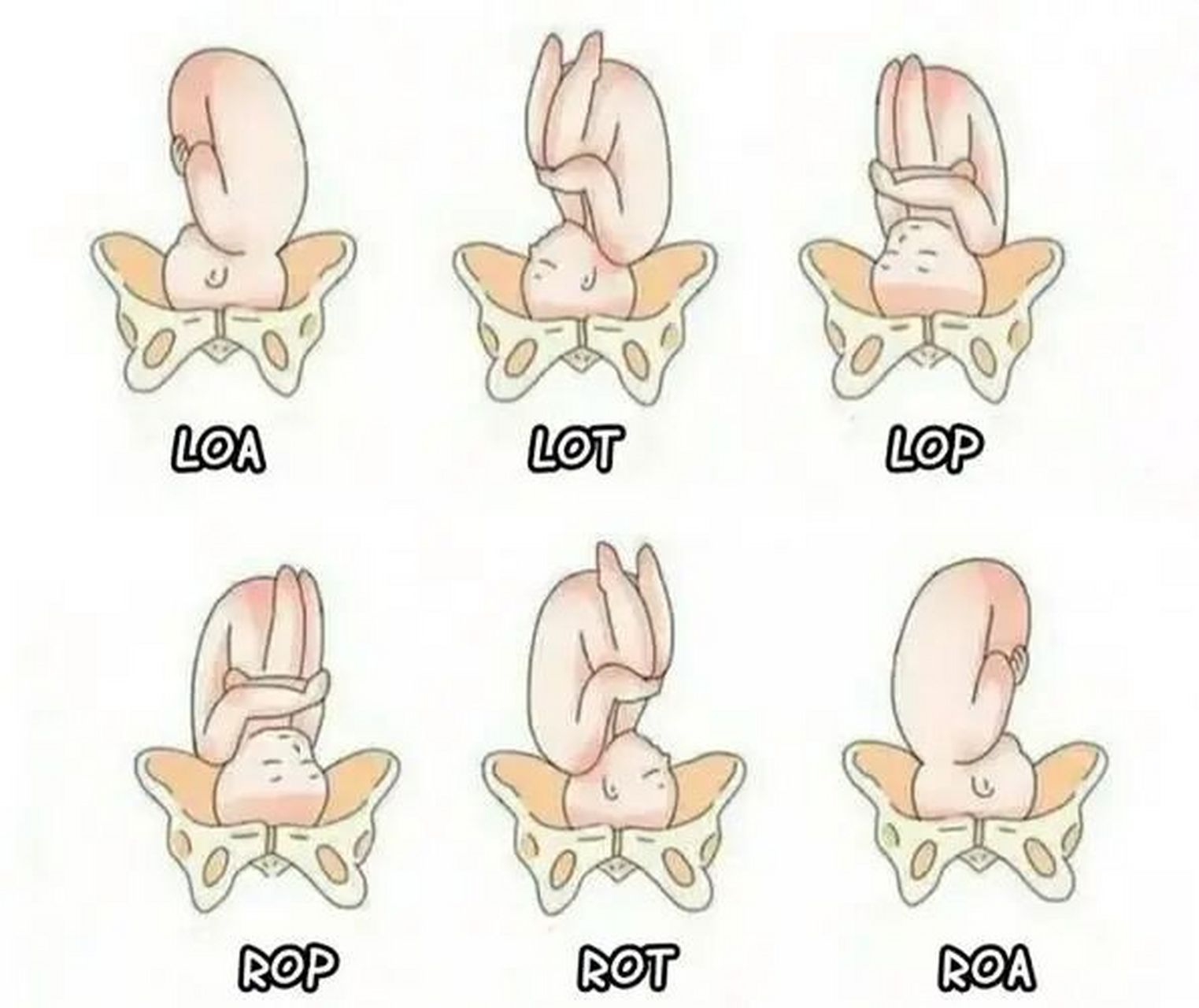 一图看懂胎方位 胎方位是指先露部的指示点与产妇骨盆的关系