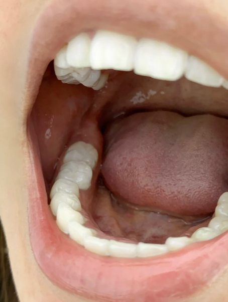 为什么牙齿很臭?百科在线 为什么牙齿很臭?百科在线