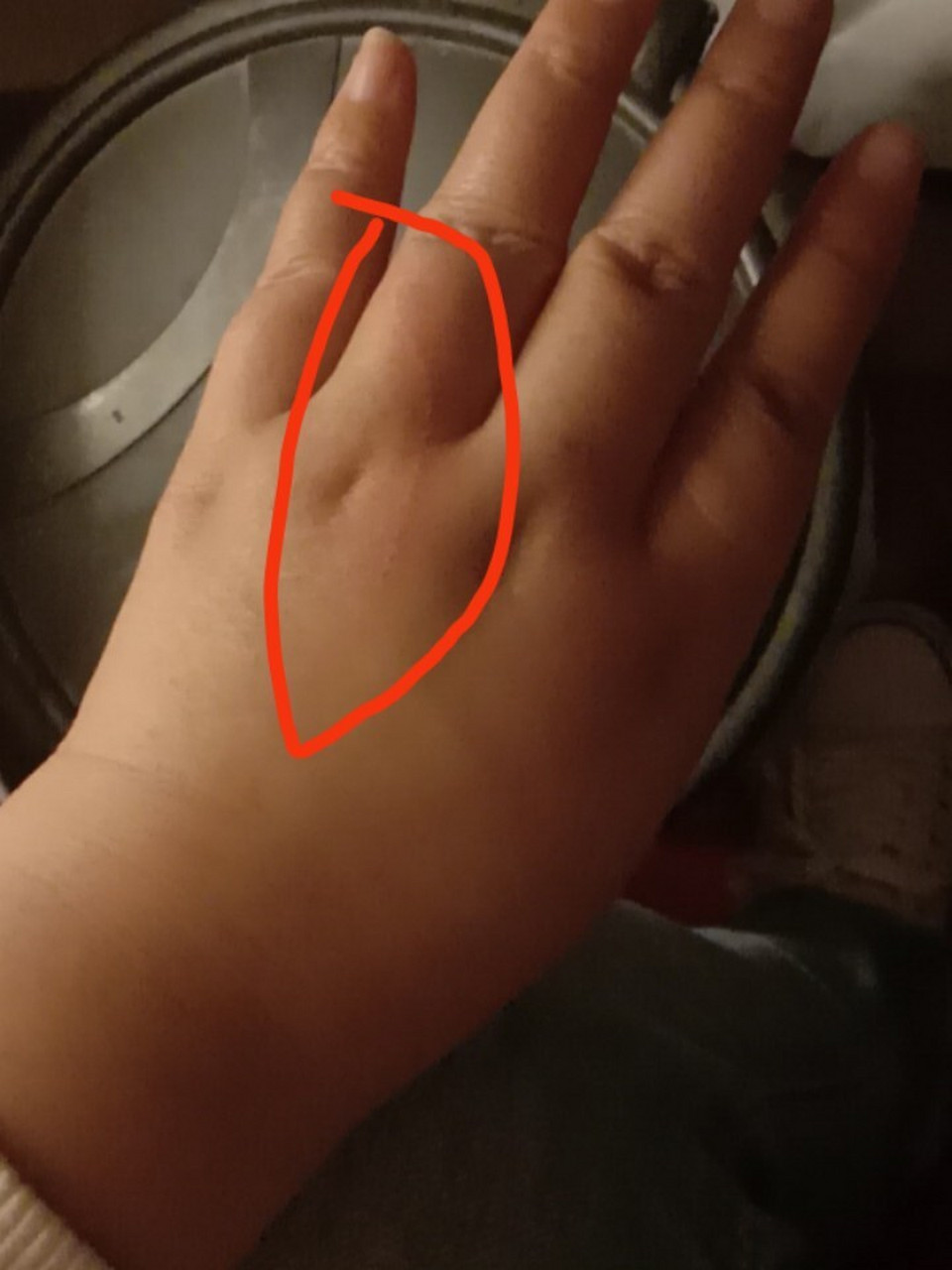 被2个月大的幼猫抓伤要不要打狂犬病疫苗?