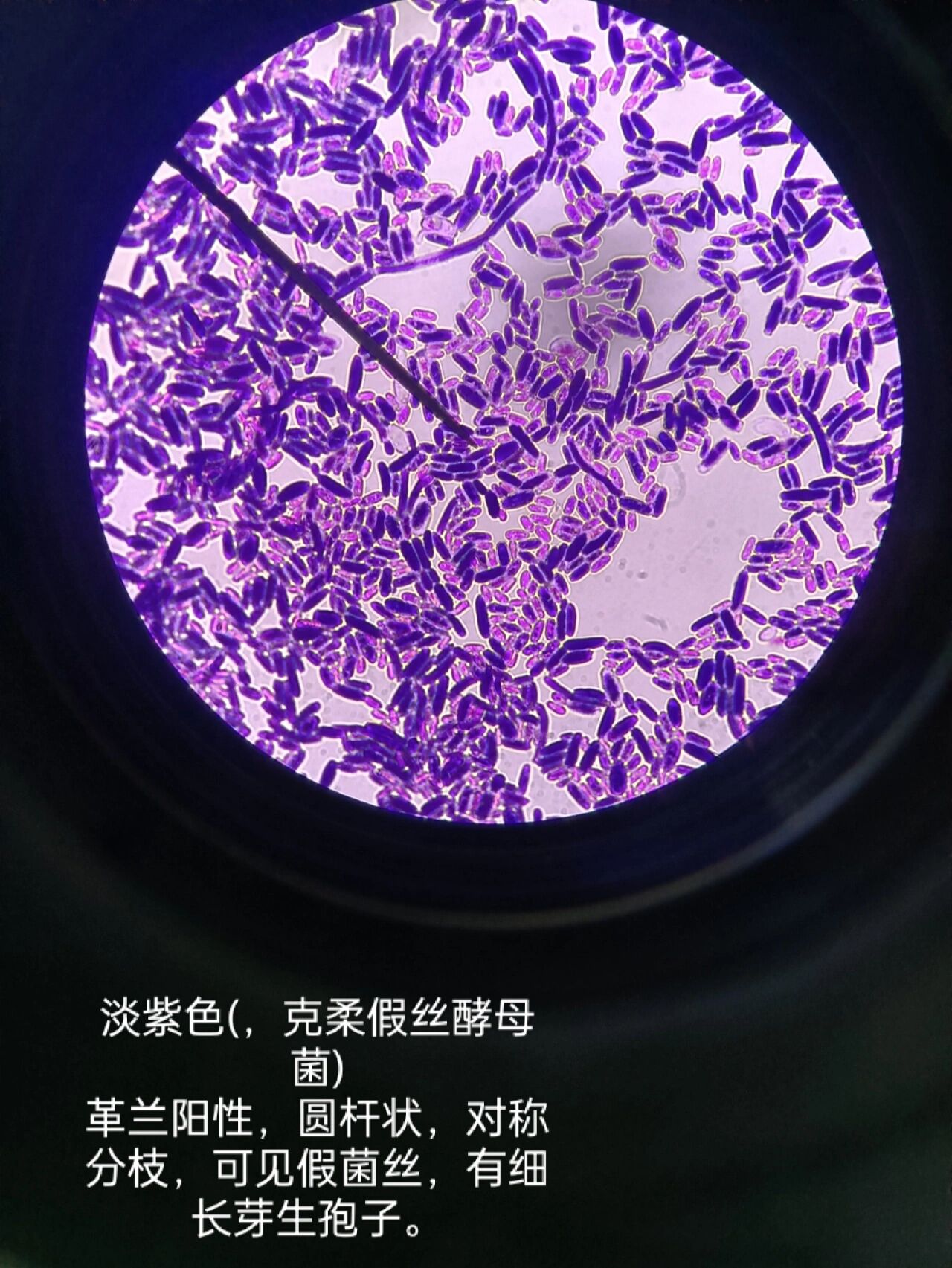 念珠菌家族969696 接上篇,是各个念珠菌革兰染色后的镜下形态