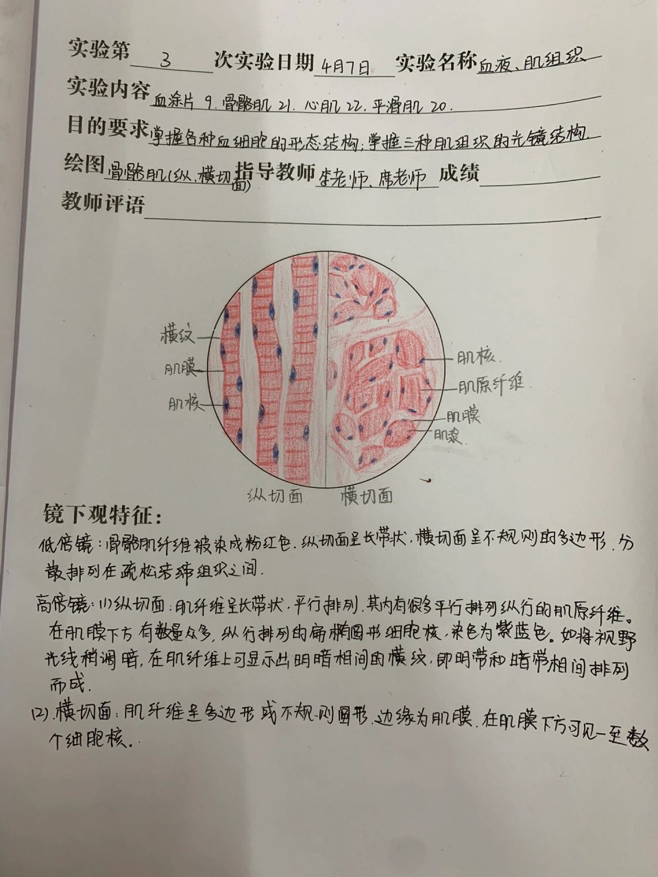 骨骼肌纵横切面红蓝铅笔绘图7315 组胚画图真的好难01