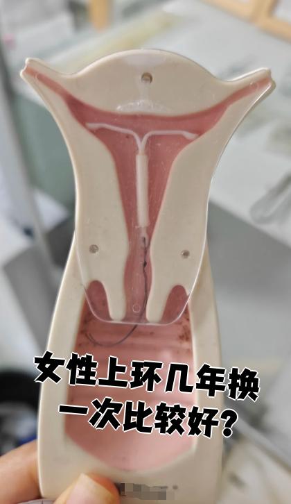 上环指的是放置节育环.节育环需要几年更换一次,主要看它的材质