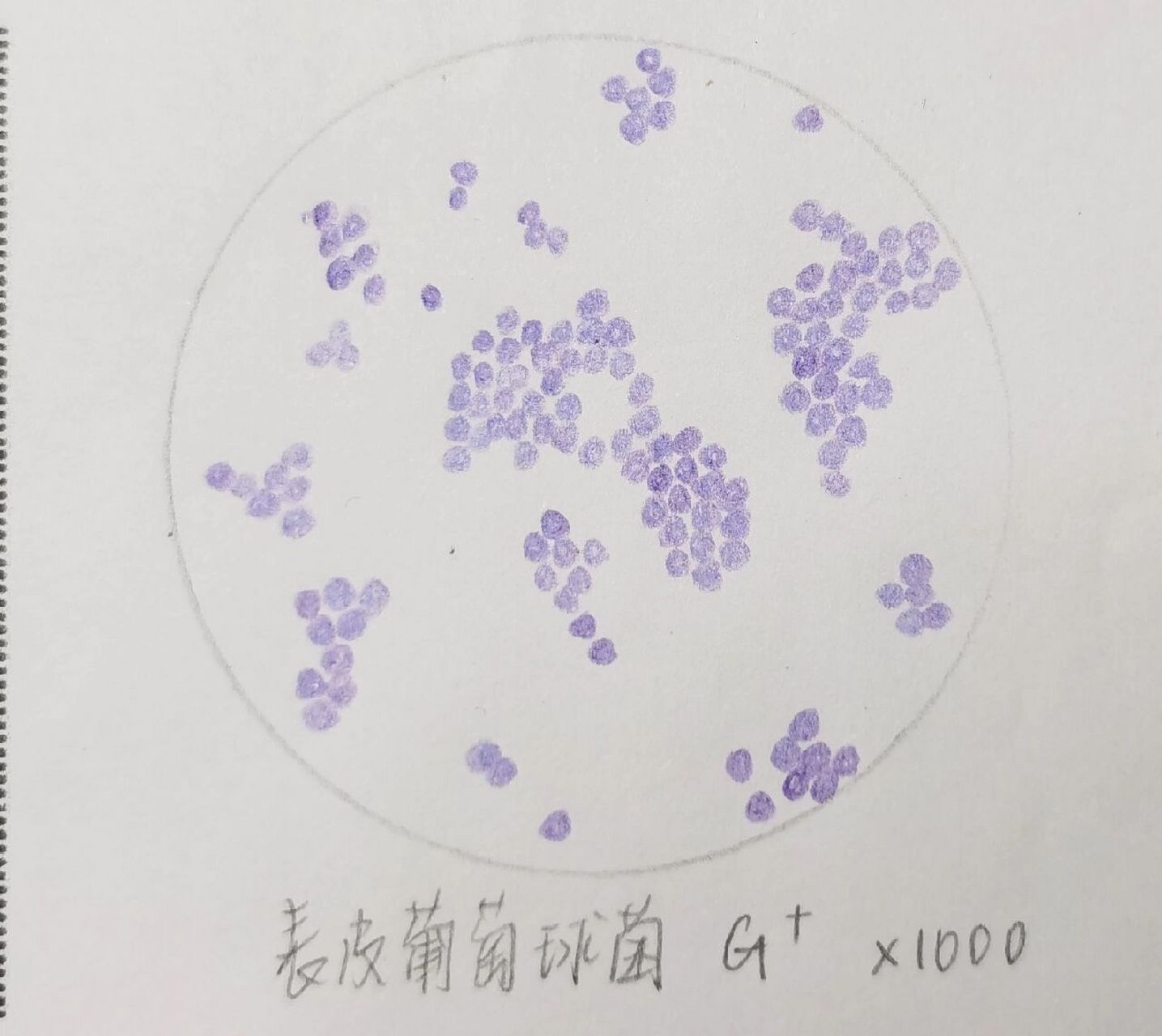 幽门螺杆菌手绘图红蓝图片