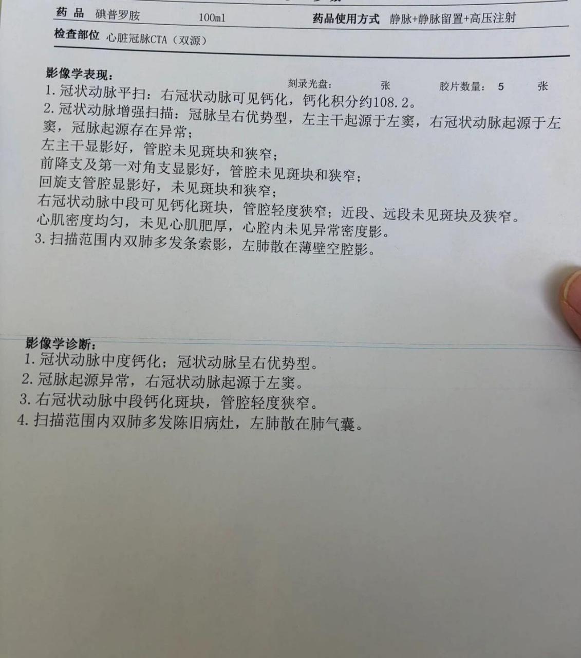 漏斗胸ct报告图片图片