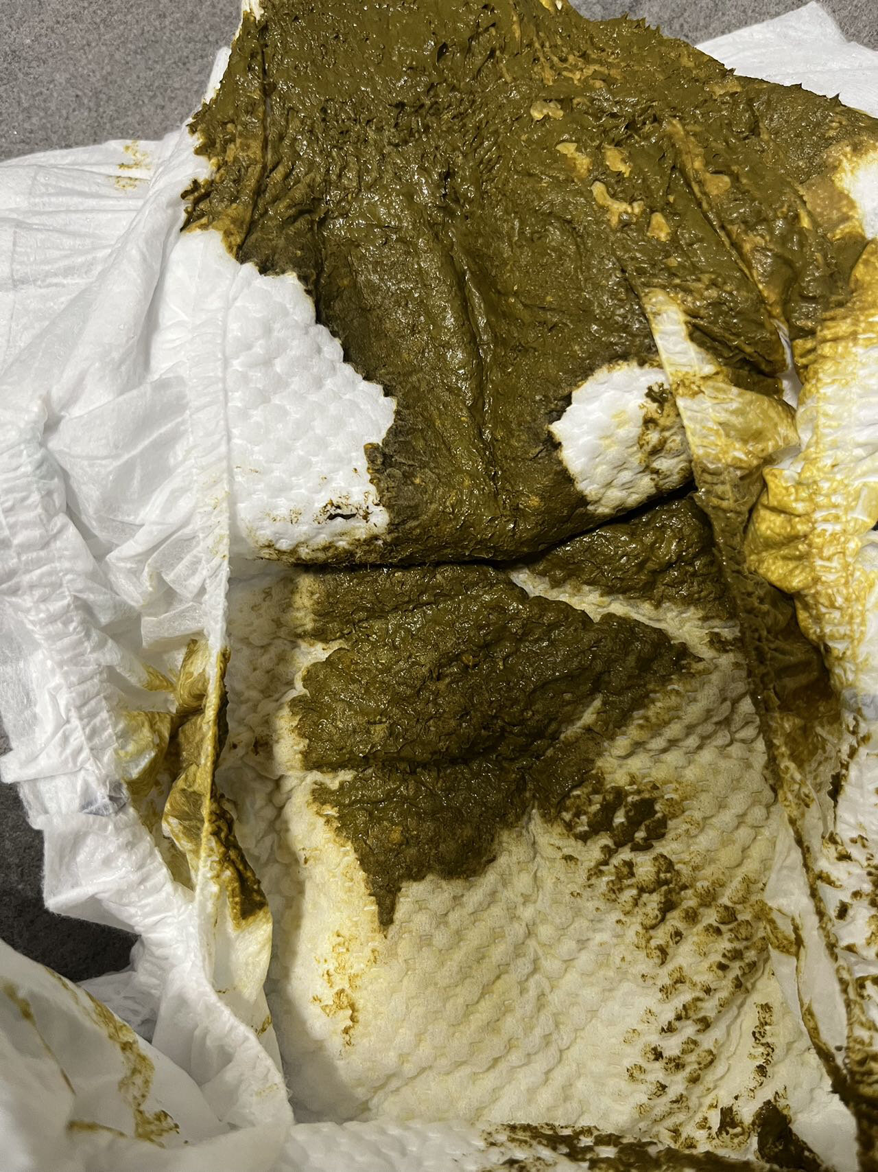 真实粑粑的图片水解奶粉喝了大便图片宝宝受凉拉的粑粑图片拉粑粑照片