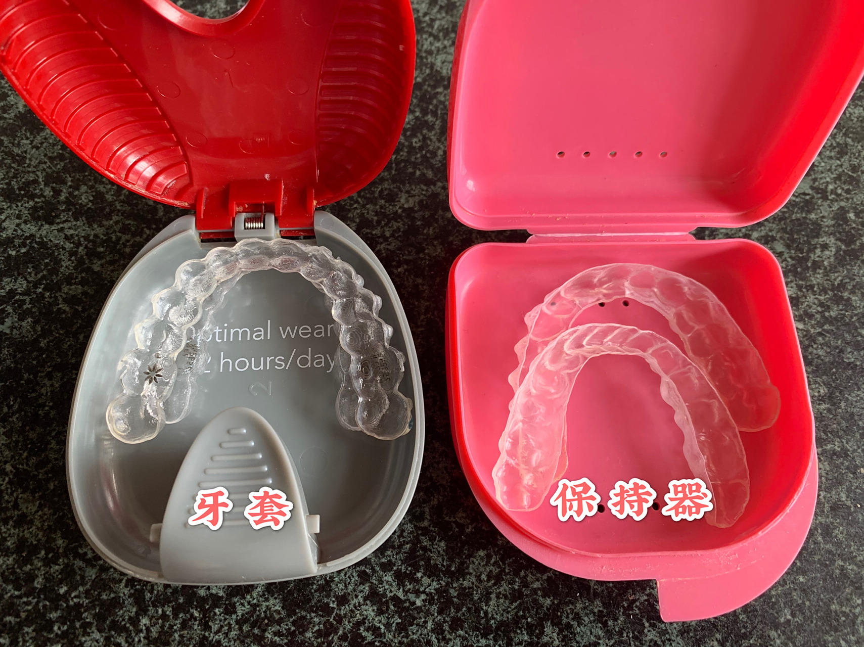 隐形牙套【隐适美】牙套vs保持器(材质) 年初做第二批牙套时,戴了几个
