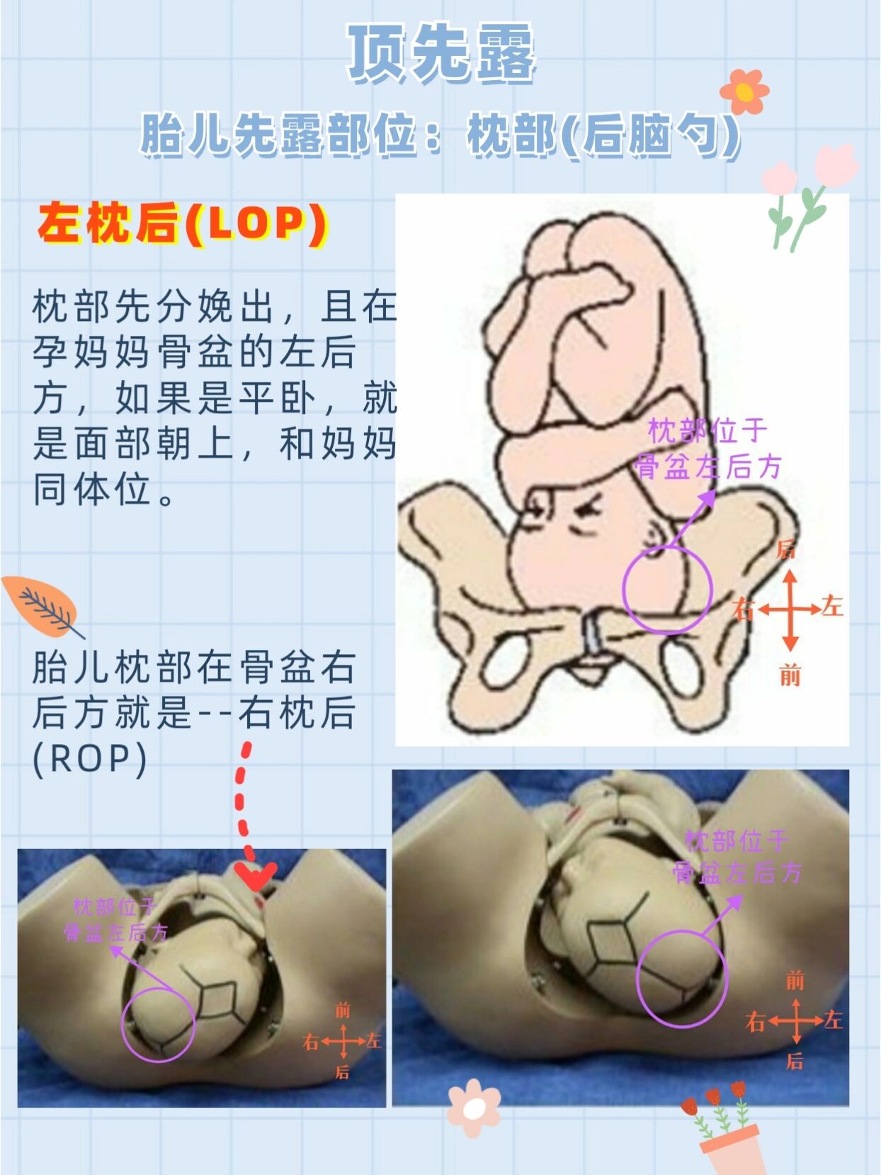 左枕头位图胎儿图片