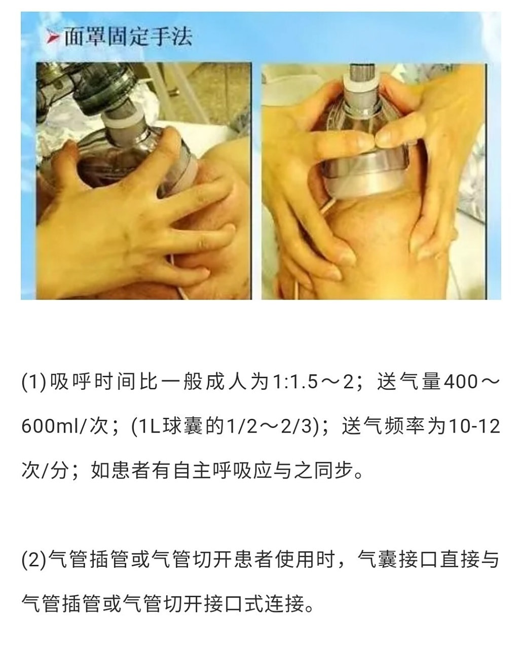 简易呼吸气囊使用方法及注意事项 简易呼吸气囊是由六个阀,球体,吸氧