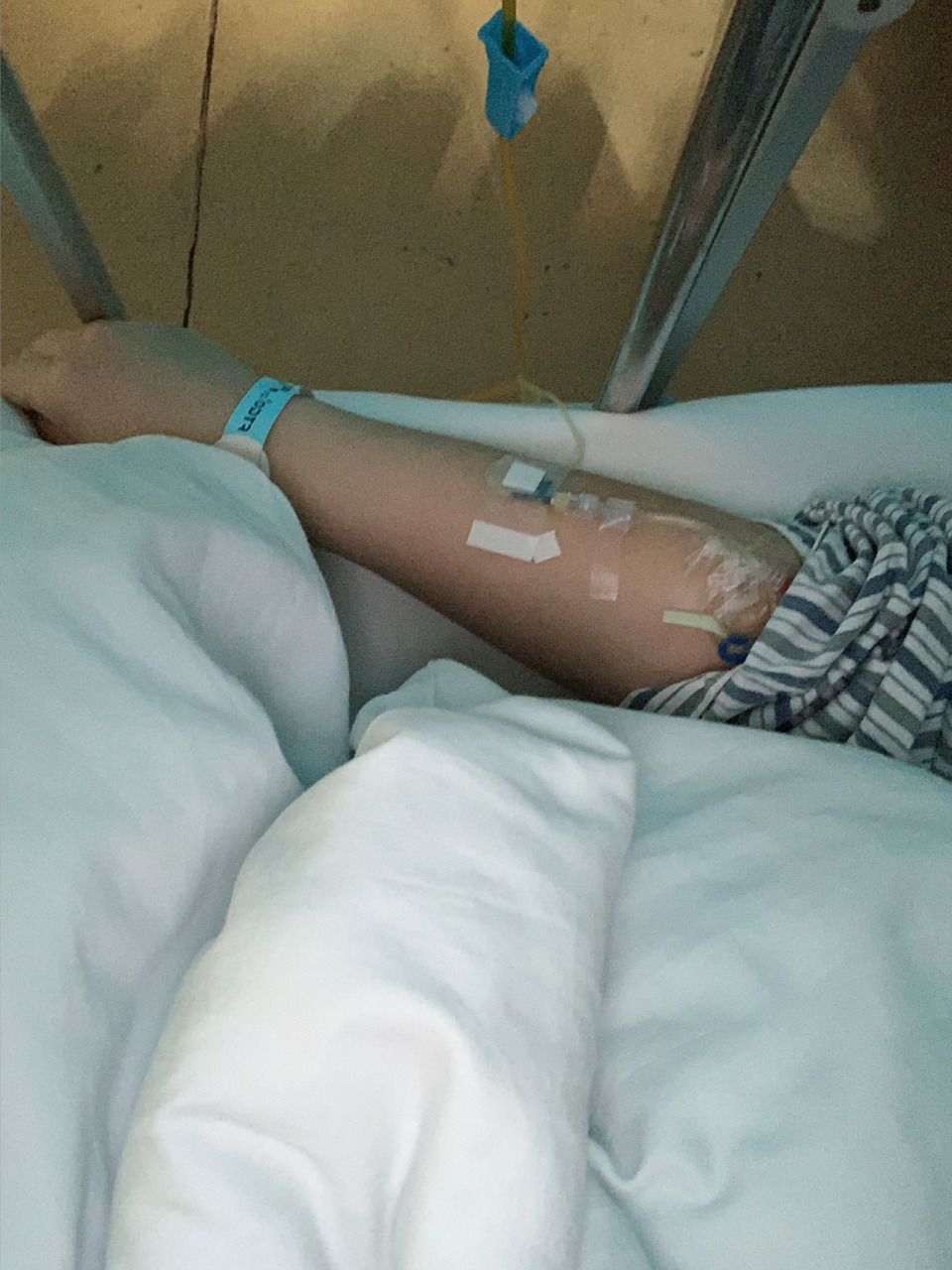 手术前打了个镇静剂在屁股上,还可以没有小时候疼!